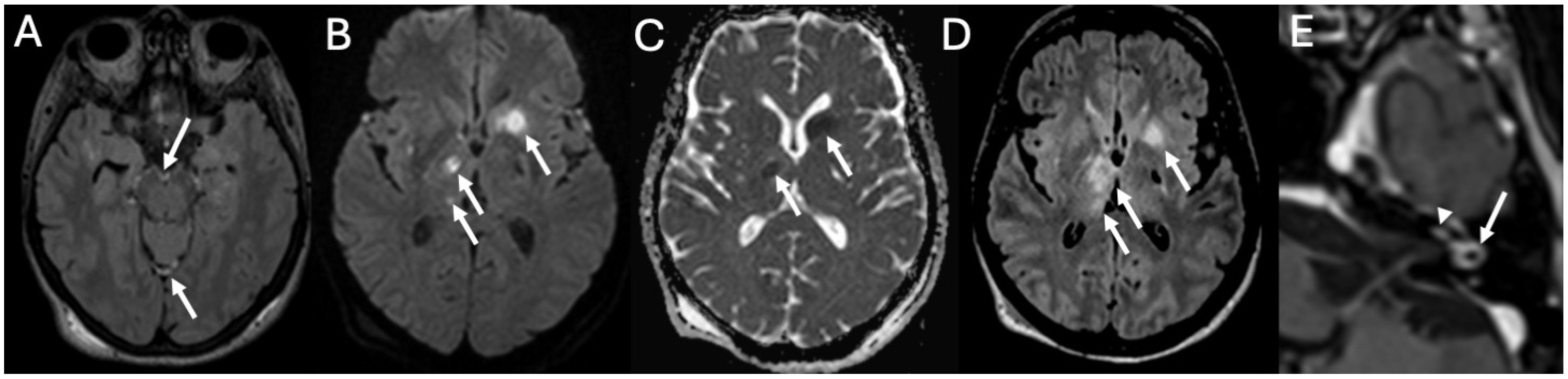 Diagnostics 15 02733 g011 Diagnostics 15 02733 g011