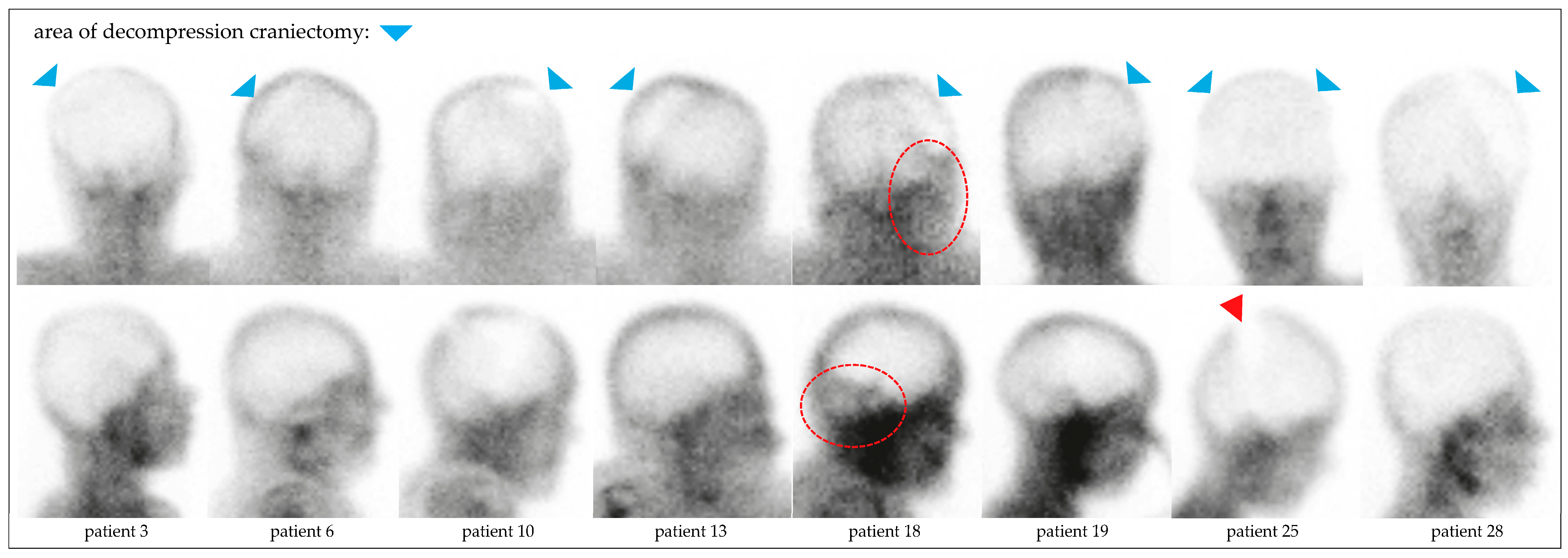 Diagnostics 15 02734 g003 Diagnostics 15 02734 g003