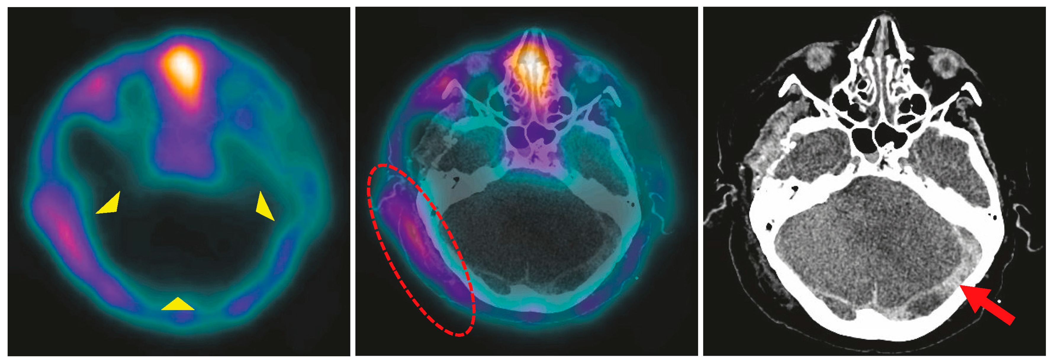 Diagnostics 15 02734 g004 Diagnostics 15 02734 g004