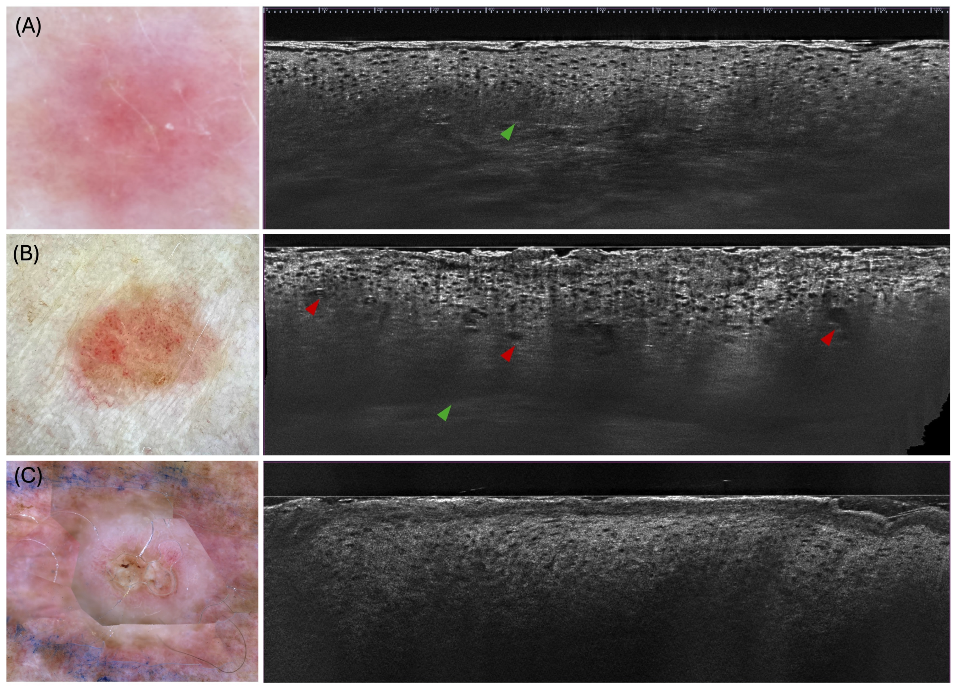Diagnostics 15 02746 g002 Diagnostics 15 02746 g002