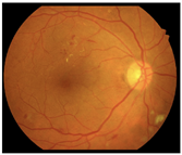 Diagnostics 15 02762 i004