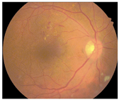 Diagnostics 15 02762 i006