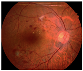 Diagnostics 15 02762 i012