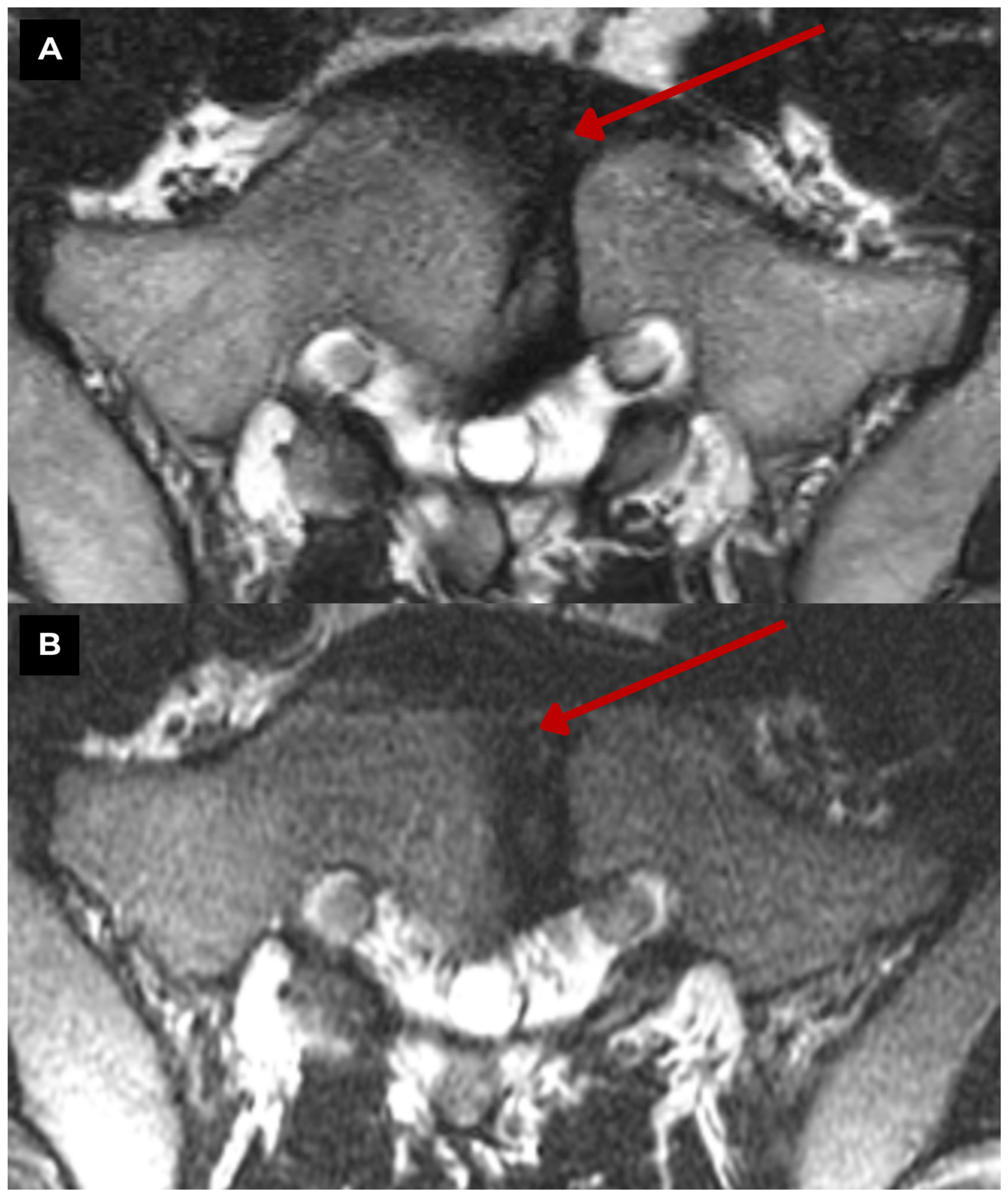 Diagnostics 15 02775 g003 Diagnostics 15 02775 g003