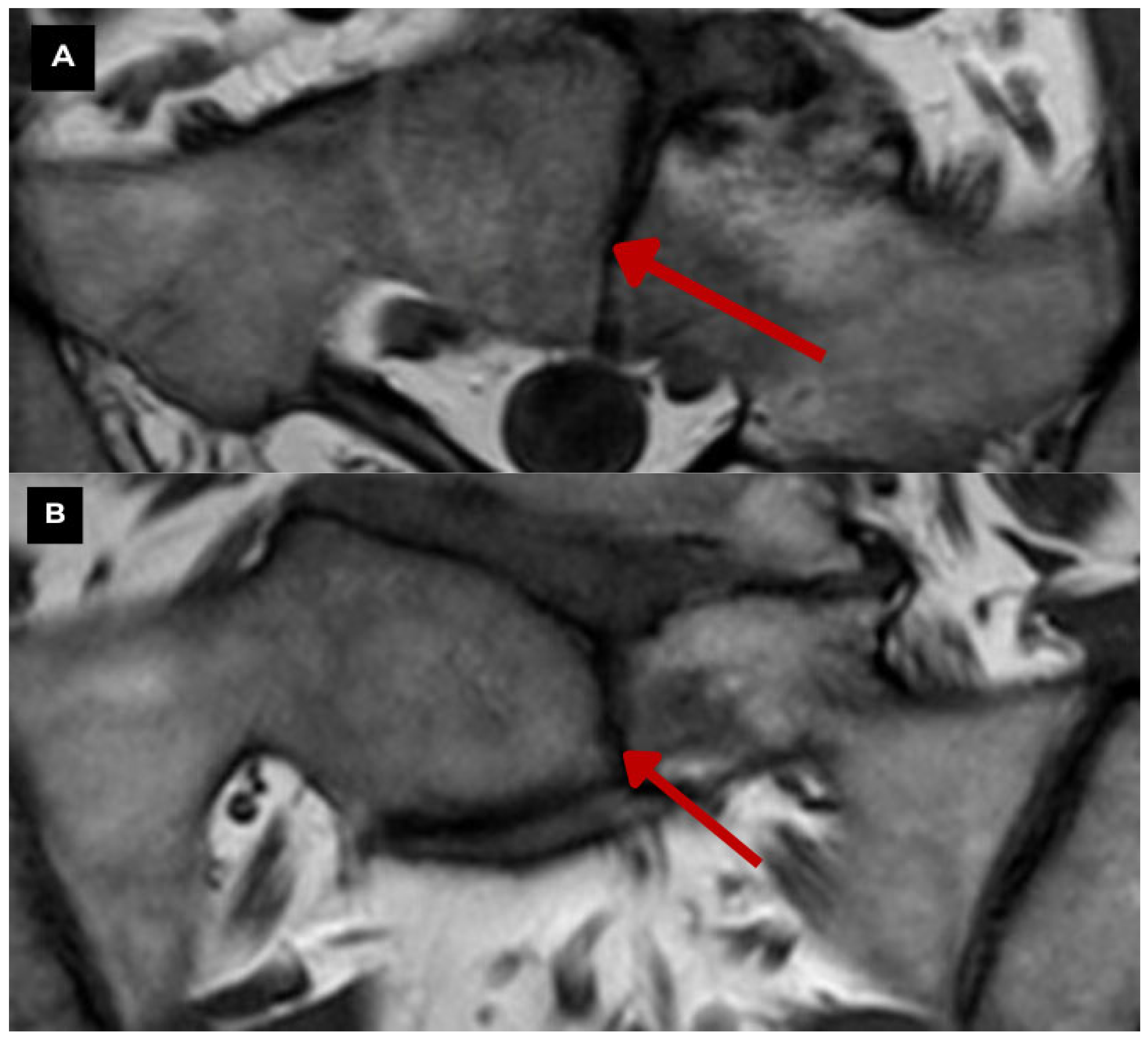 Diagnostics 15 02775 g006a Diagnostics 15 02775 g006a