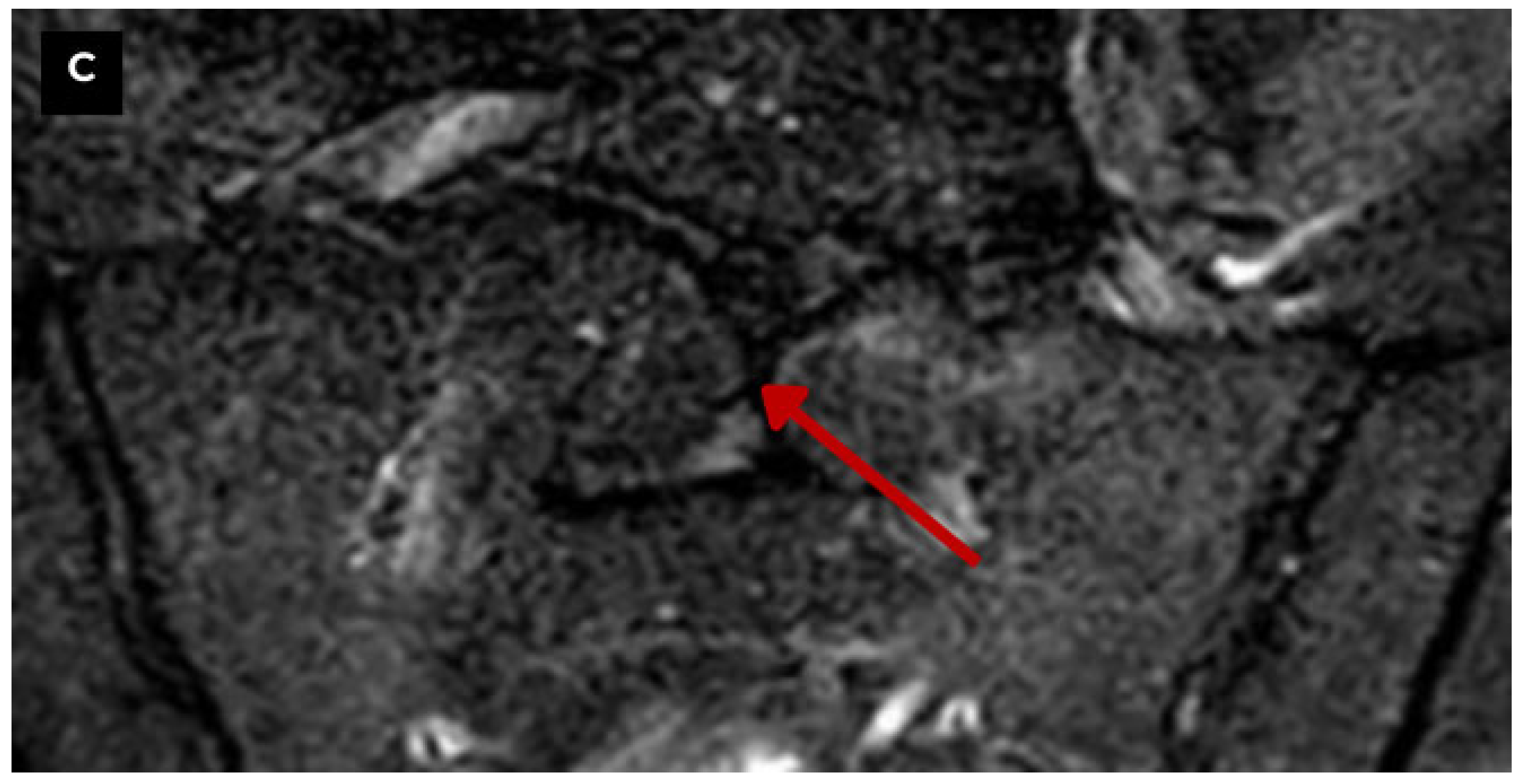 Diagnostics 15 02775 g006b Diagnostics 15 02775 g006b