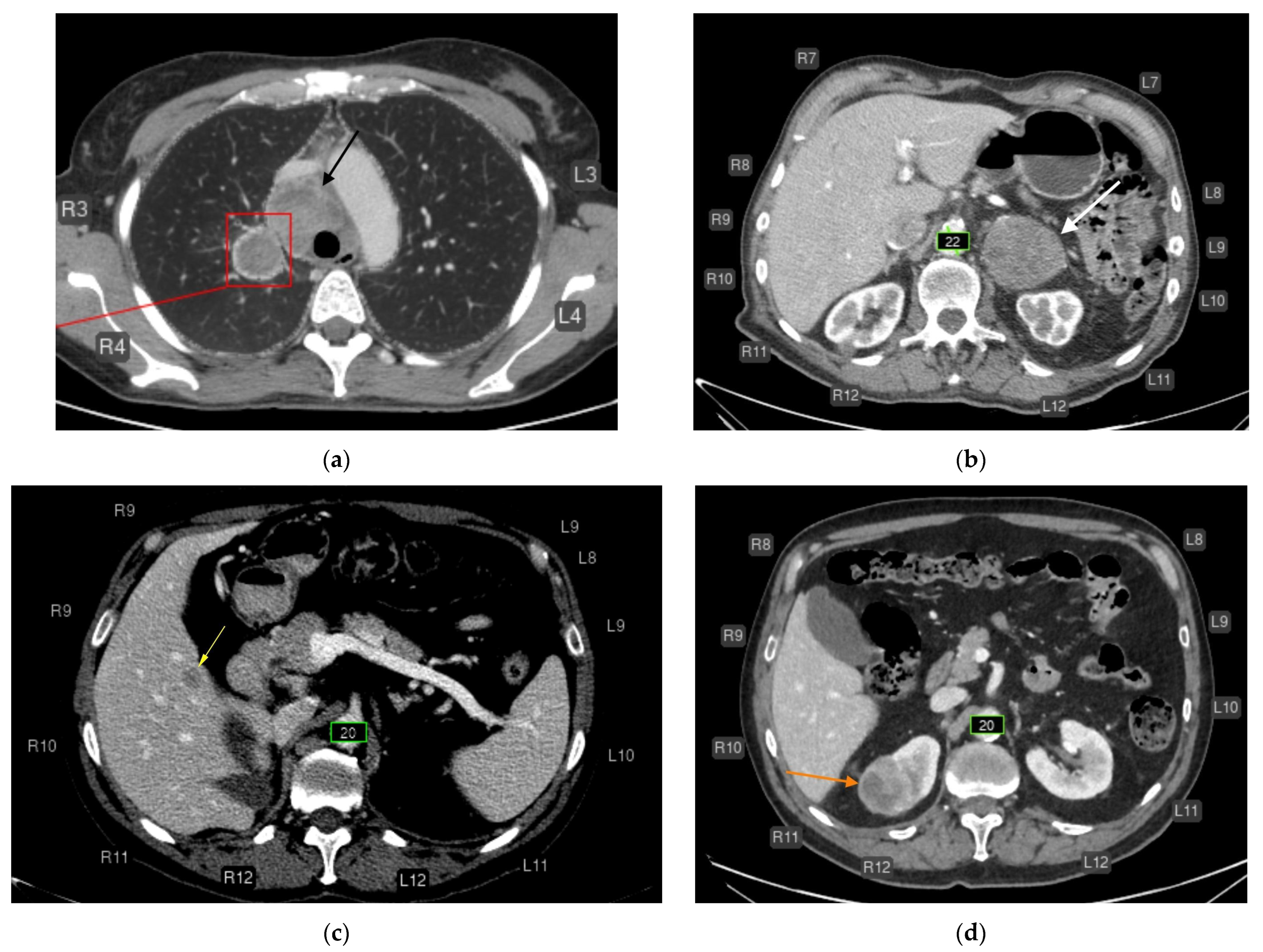 Diagnostics 15 02778 g004