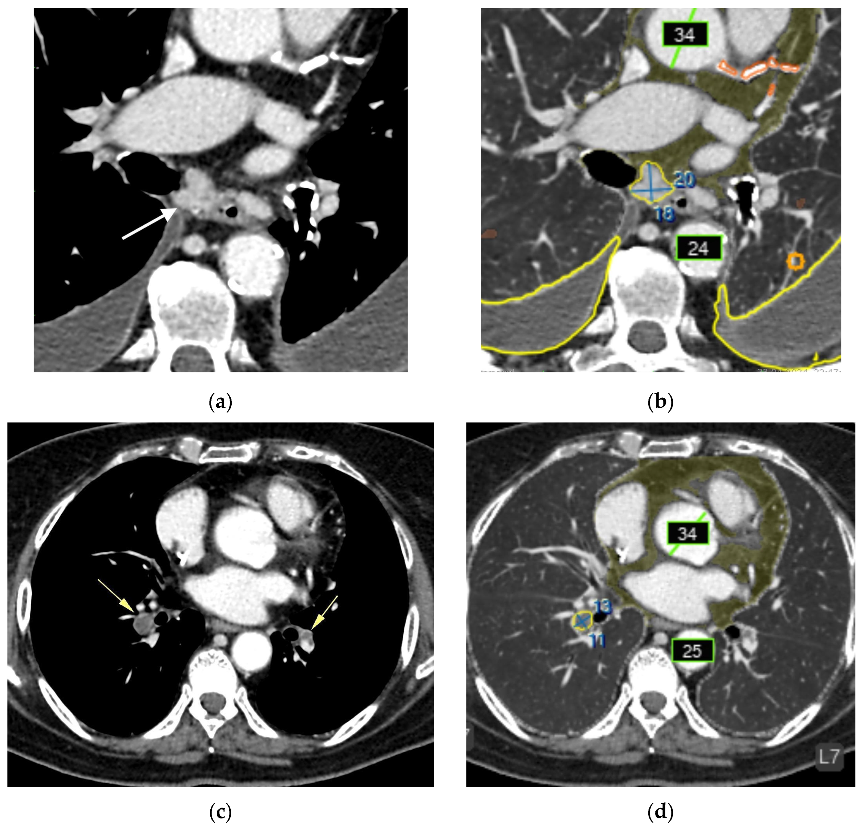 Diagnostics 15 02778 g005