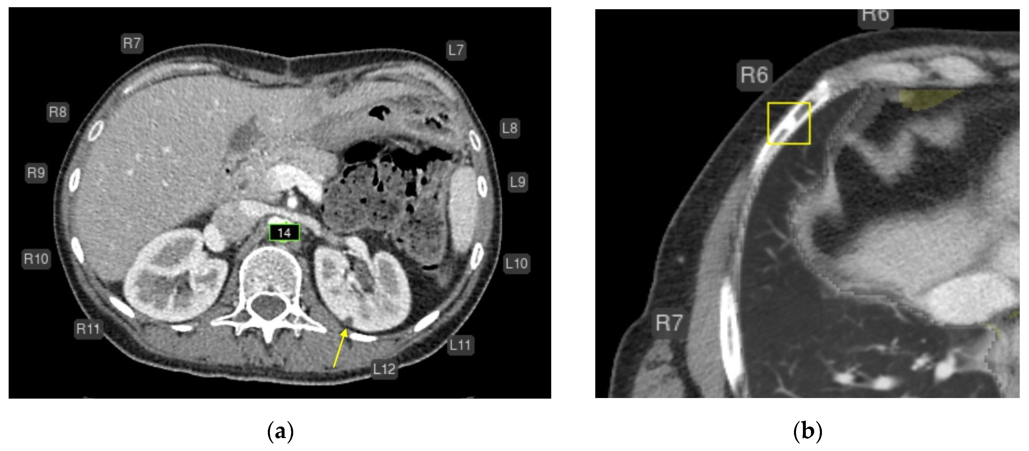 Diagnostics 15 02778 g006
