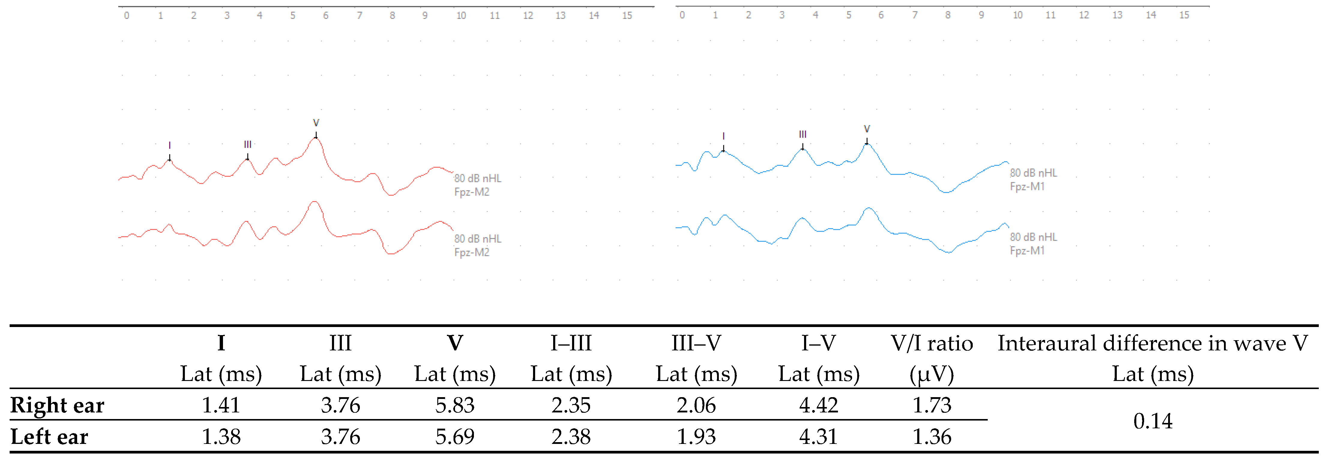 Diagnostics 15 02779 g001 Diagnostics 15 02779 g001