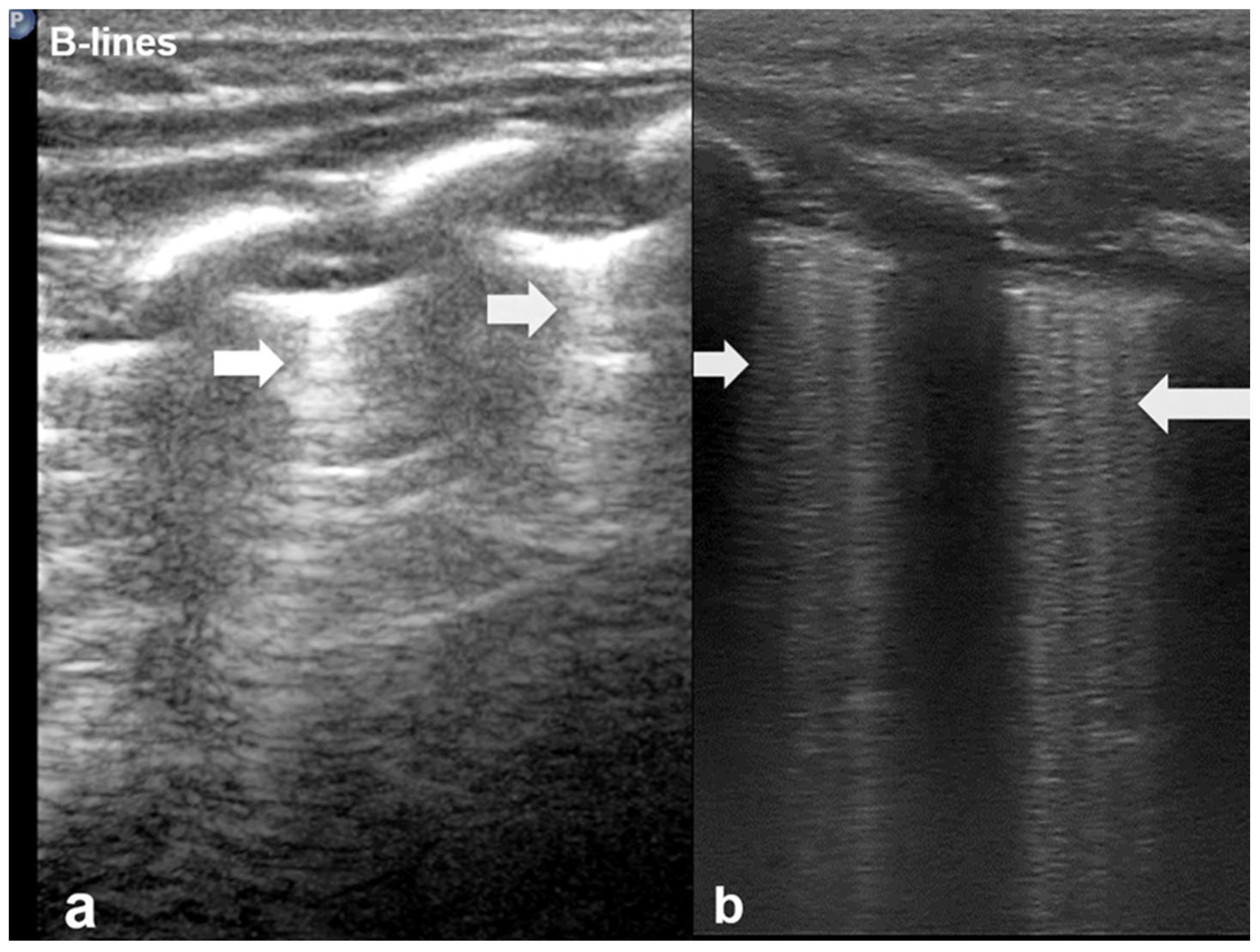 Diagnostics 15 02782 g002 Diagnostics 15 02782 g002