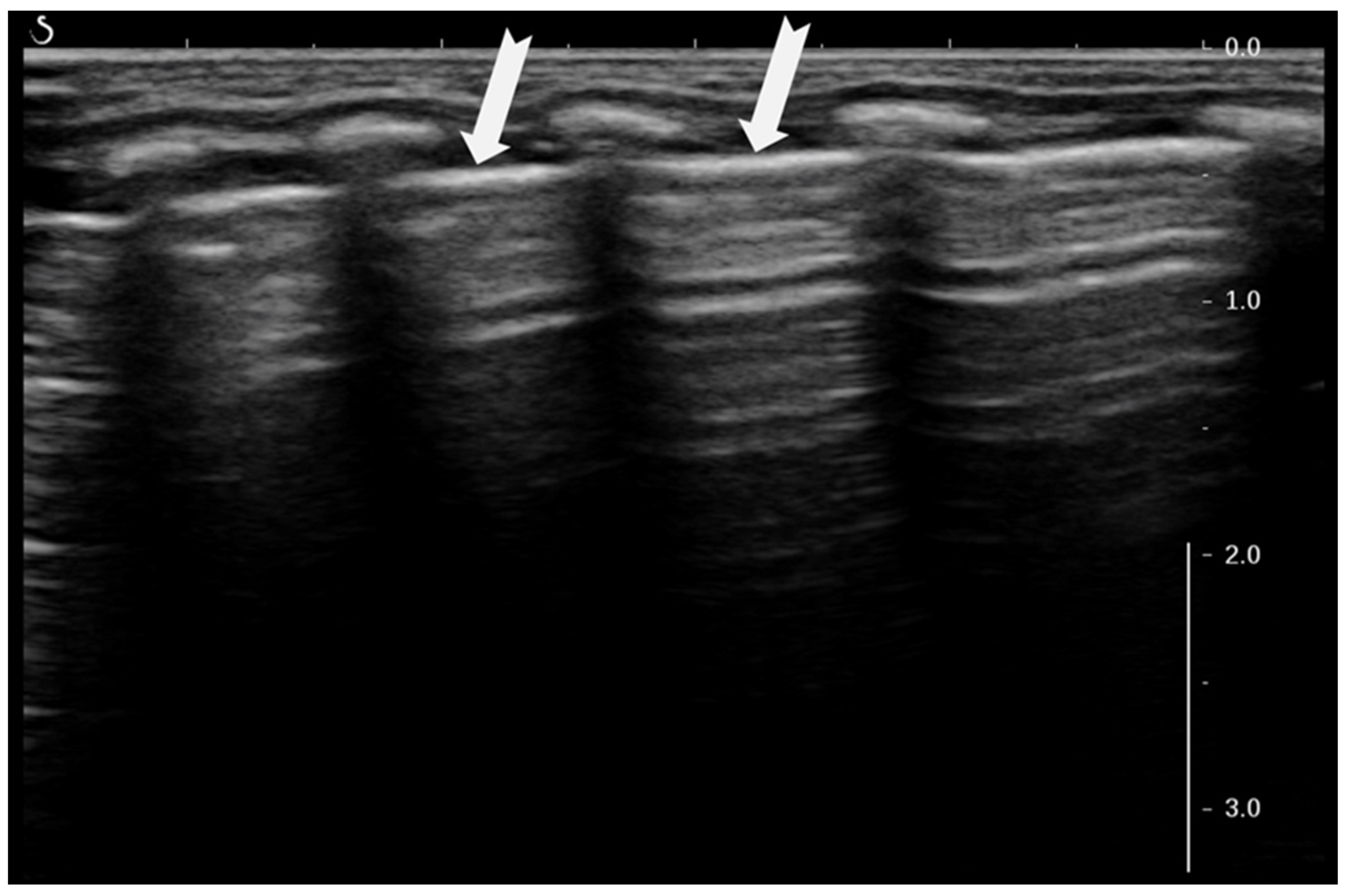 Diagnostics 15 02782 g004 Diagnostics 15 02782 g004