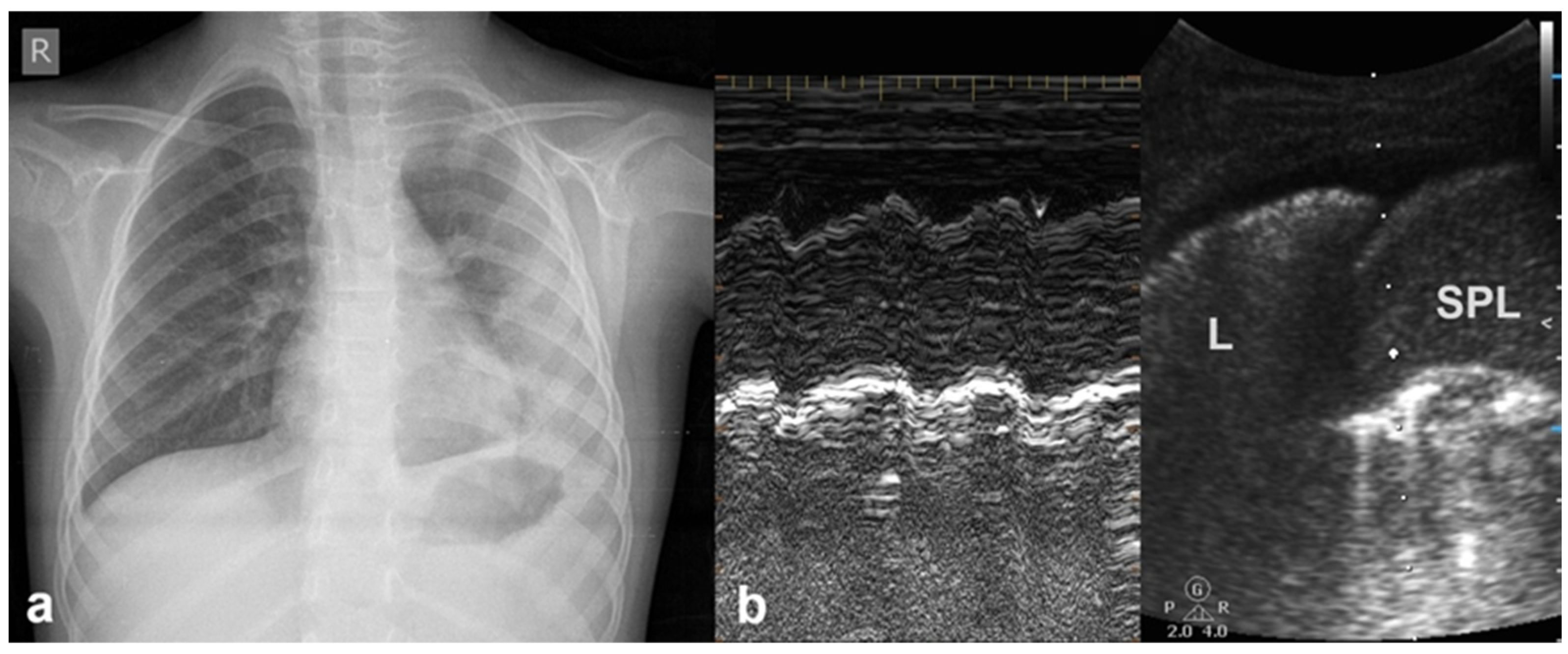 Diagnostics 15 02782 g007 Diagnostics 15 02782 g007