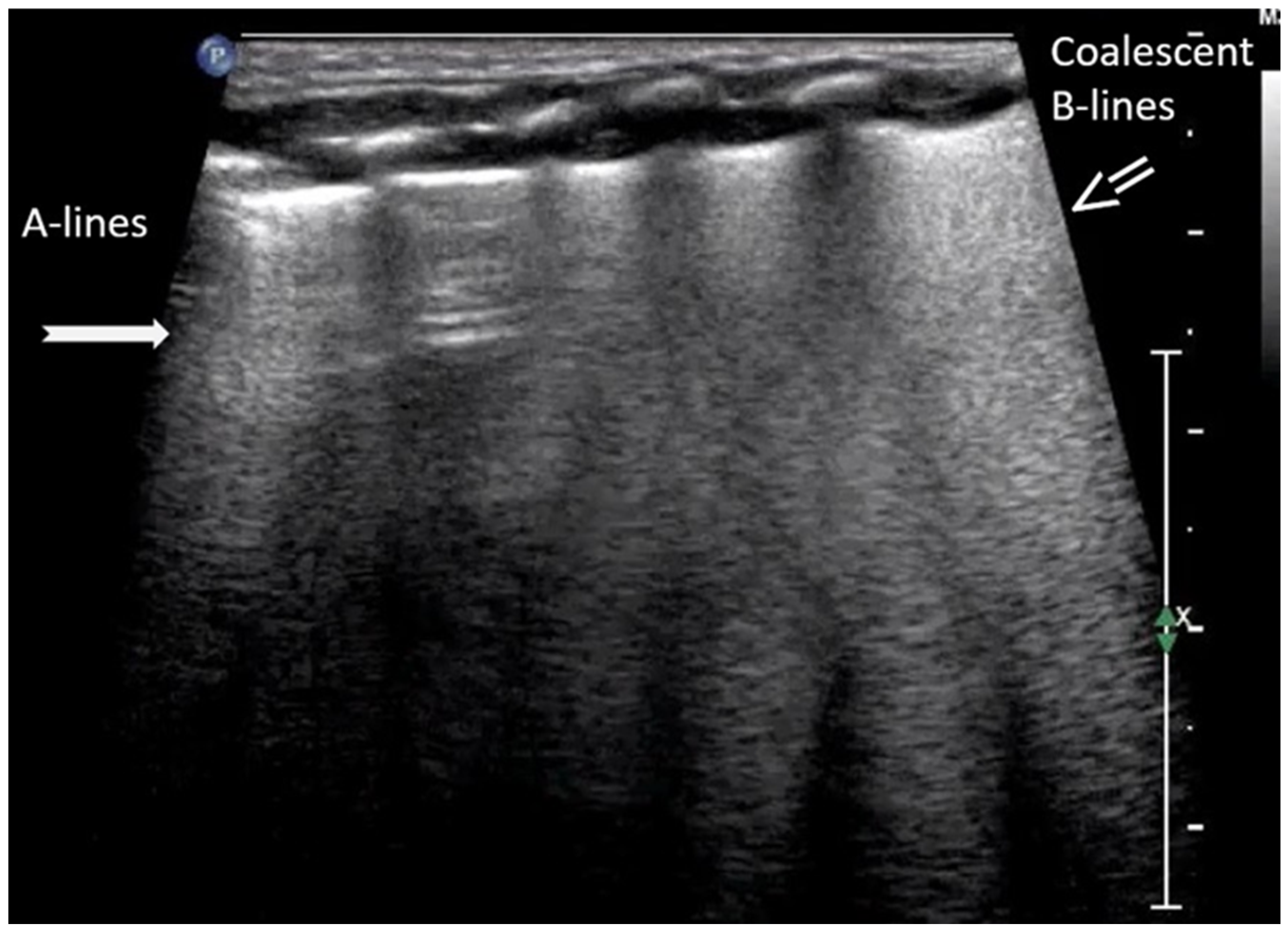 Diagnostics 15 02782 g009 Diagnostics 15 02782 g009