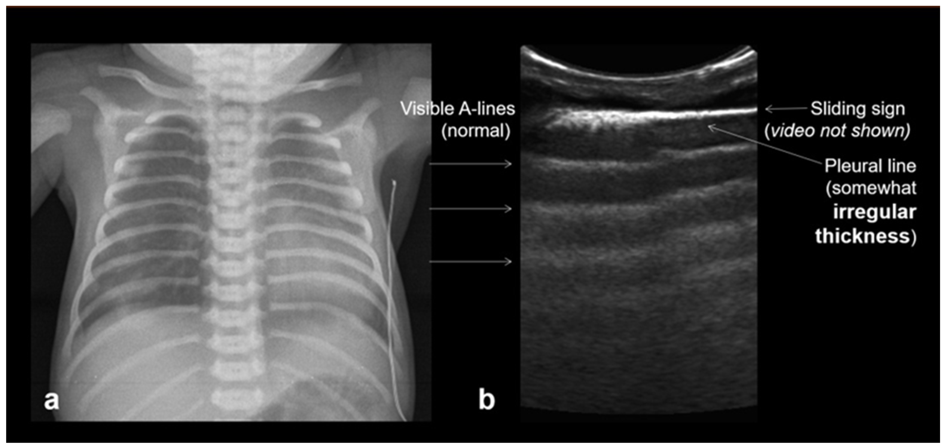 Diagnostics 15 02782 g013 Diagnostics 15 02782 g013