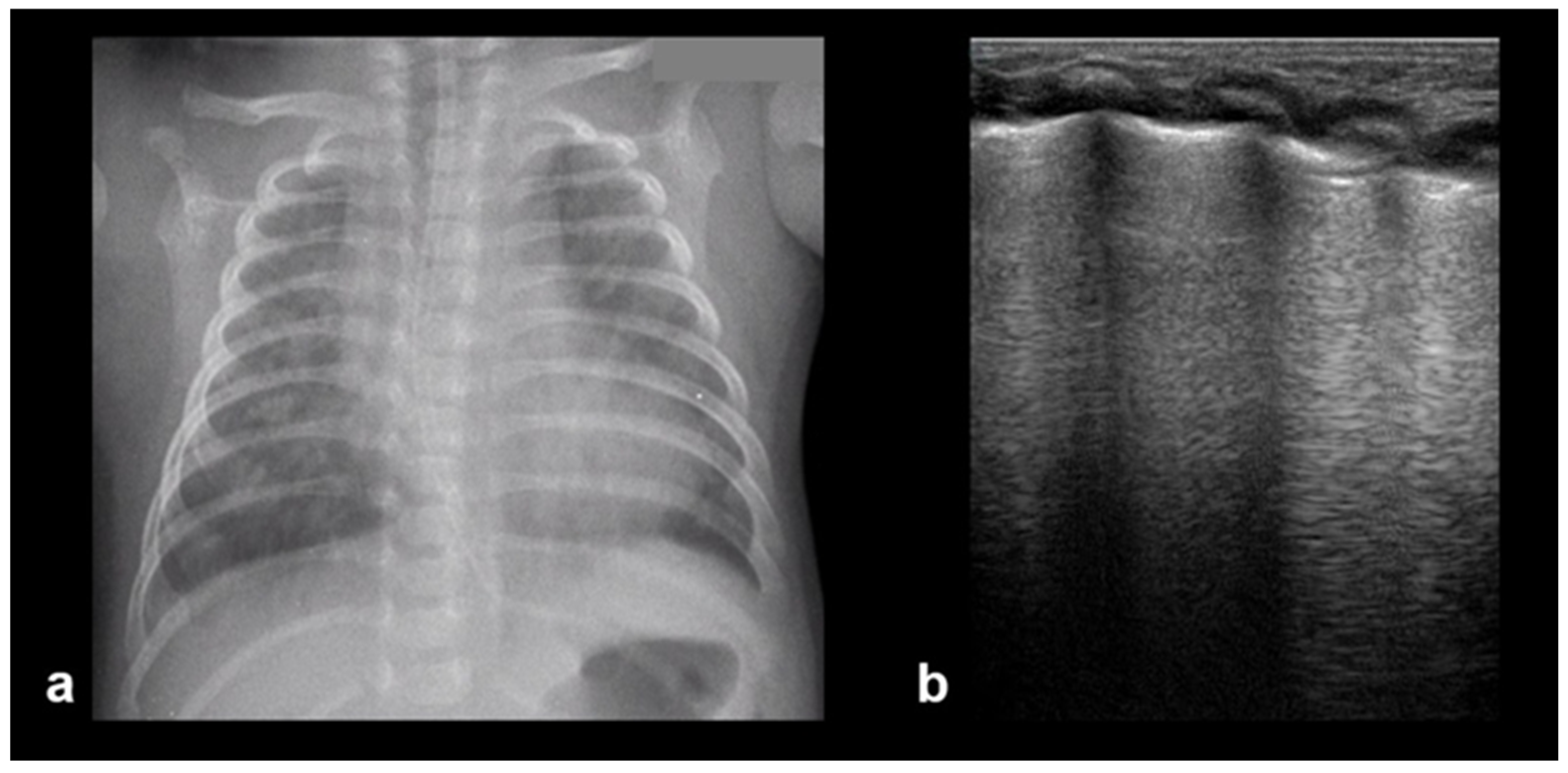 Diagnostics 15 02782 g014 Diagnostics 15 02782 g014