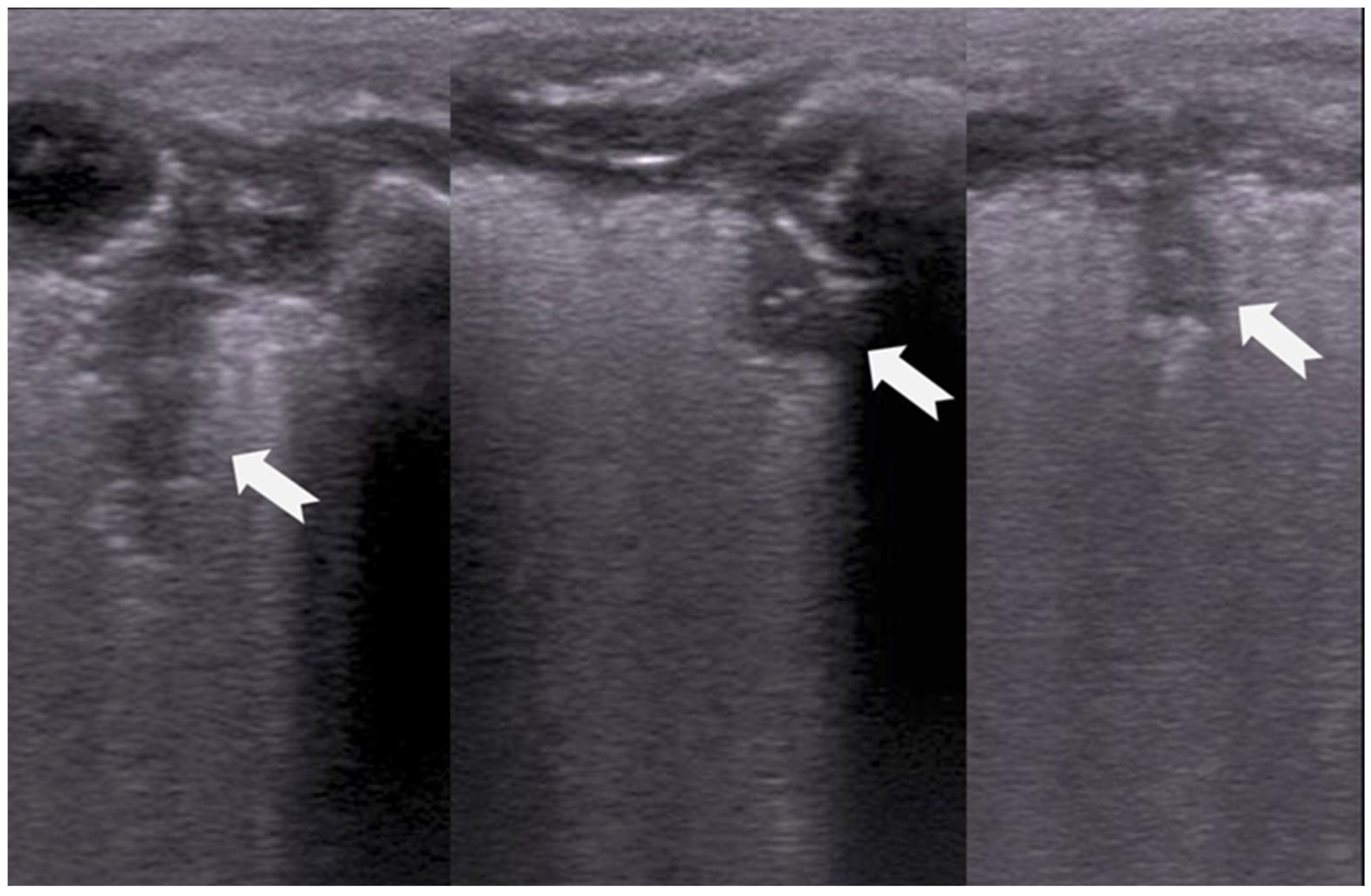 Diagnostics 15 02782 g015 Diagnostics 15 02782 g015