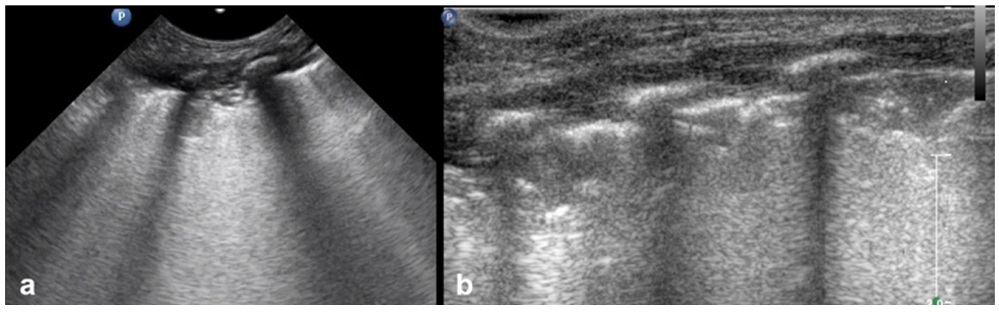 Diagnostics 15 02782 g018 Diagnostics 15 02782 g018