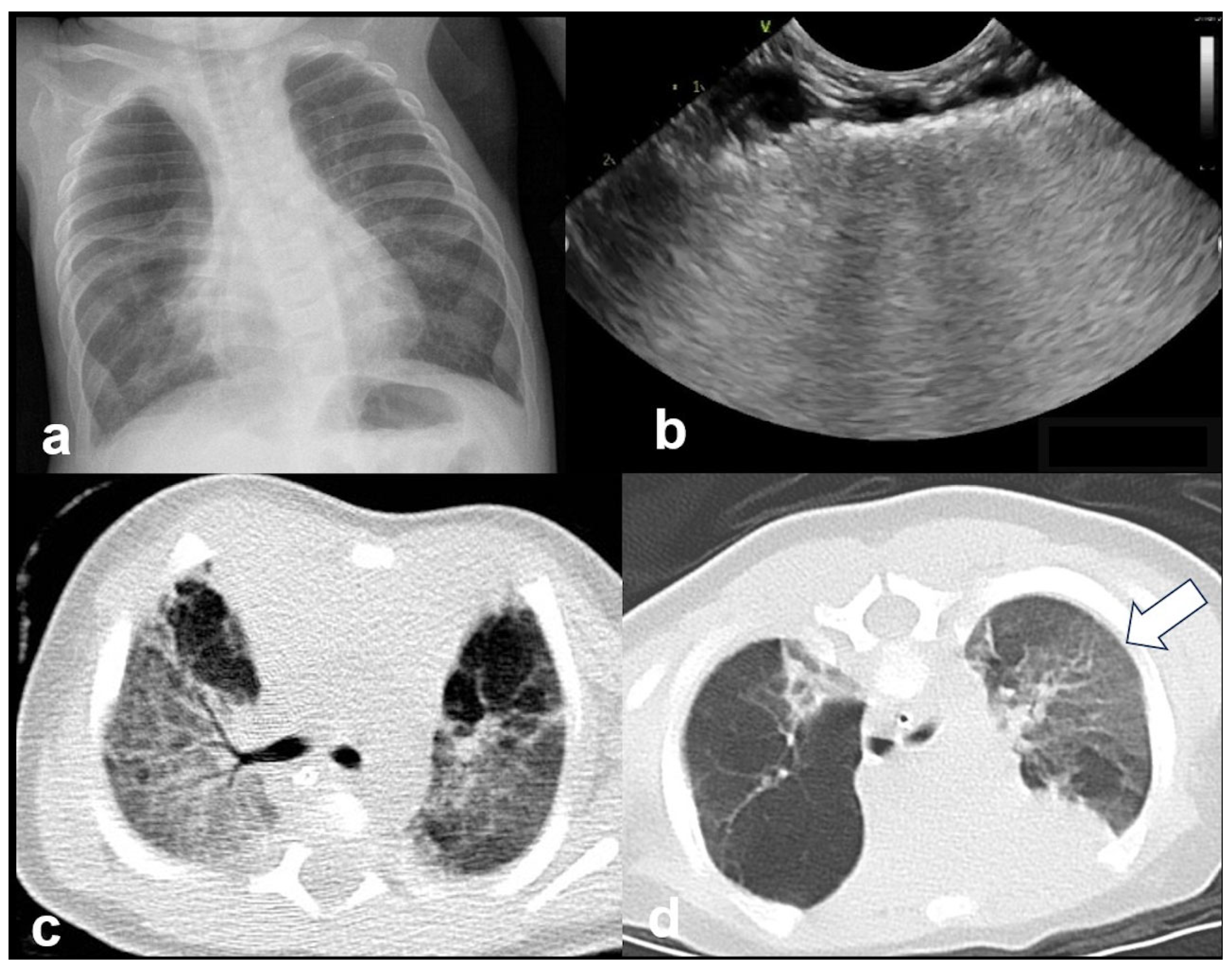 Diagnostics 15 02782 g019 Diagnostics 15 02782 g019