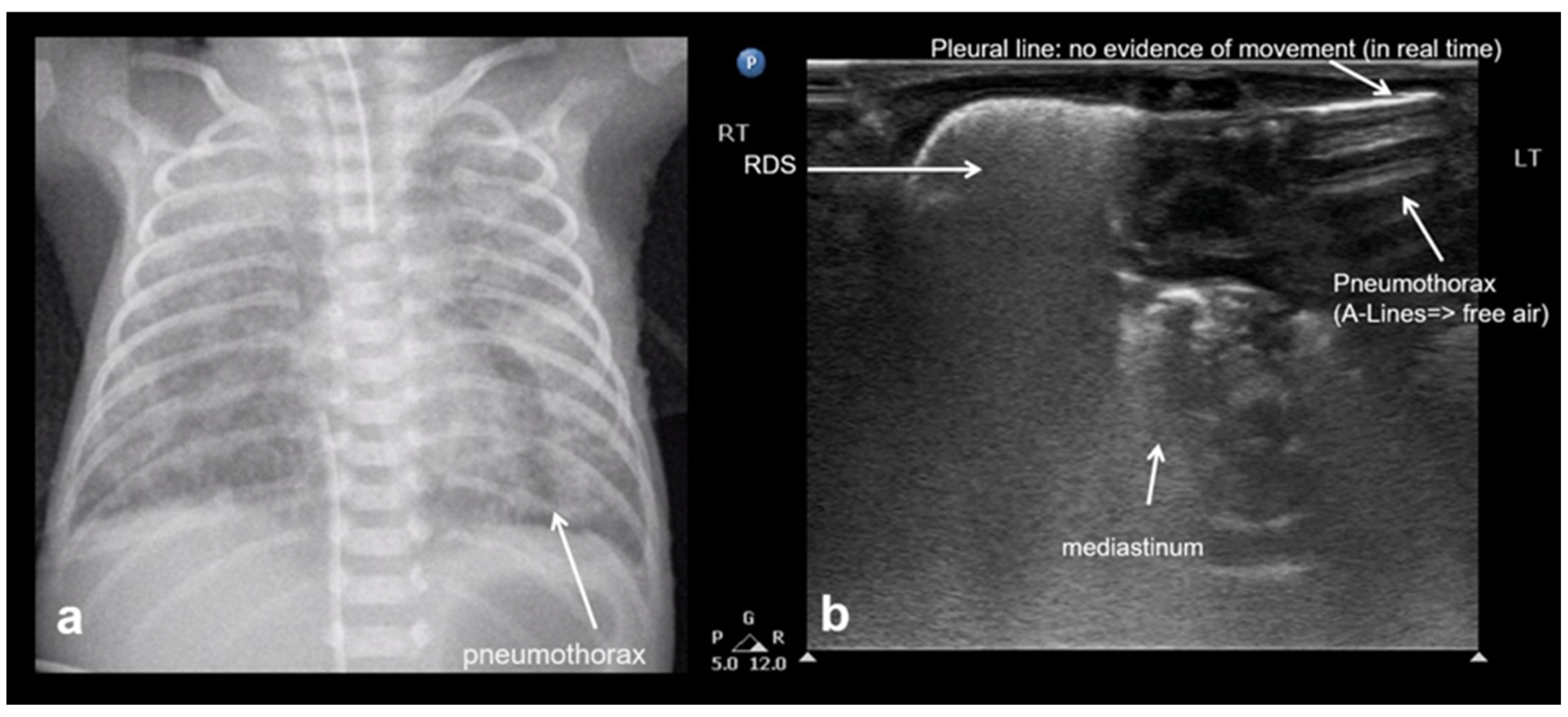 Diagnostics 15 02782 g022 Diagnostics 15 02782 g022