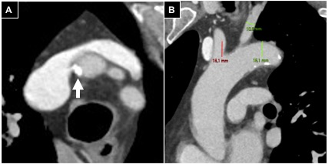 Diagnostics 15 02796 g001 Diagnostics 15 02796 g001