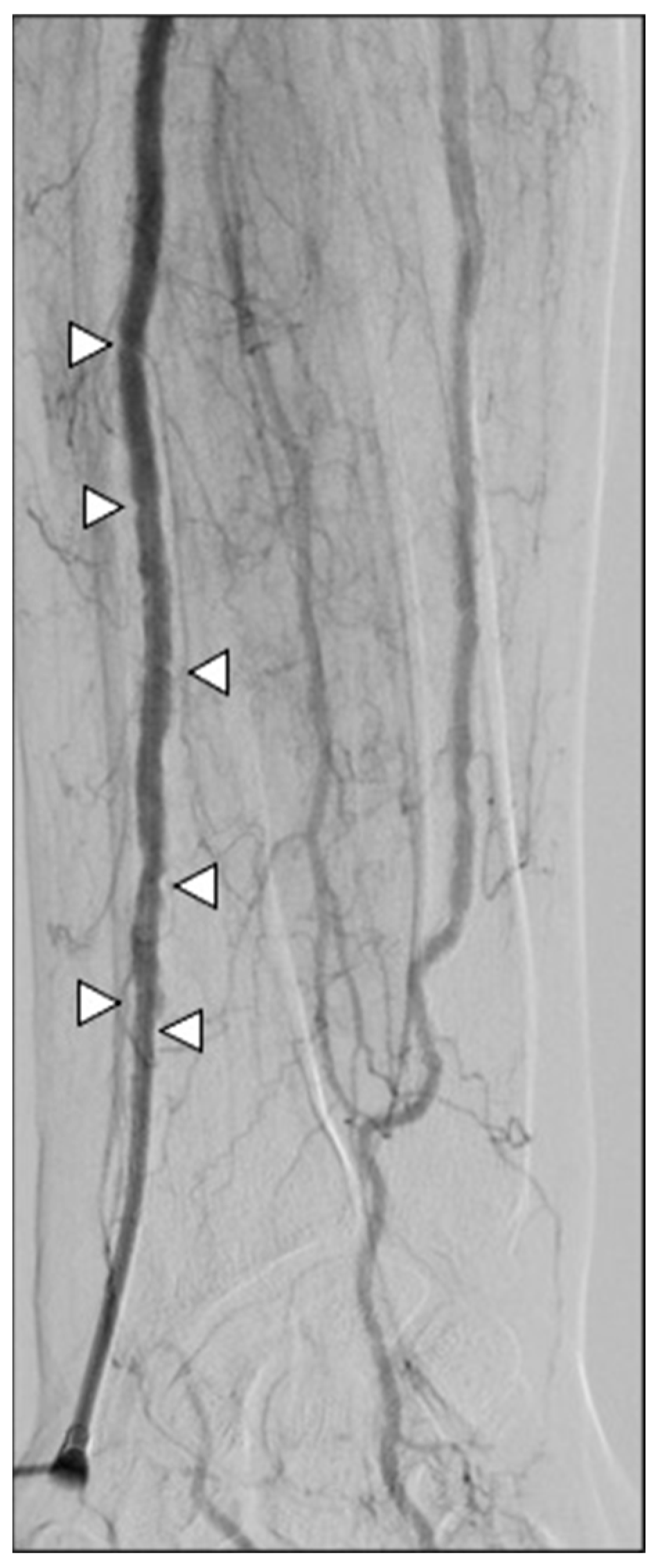 Diagnostics 15 02796 g008 Diagnostics 15 02796 g008