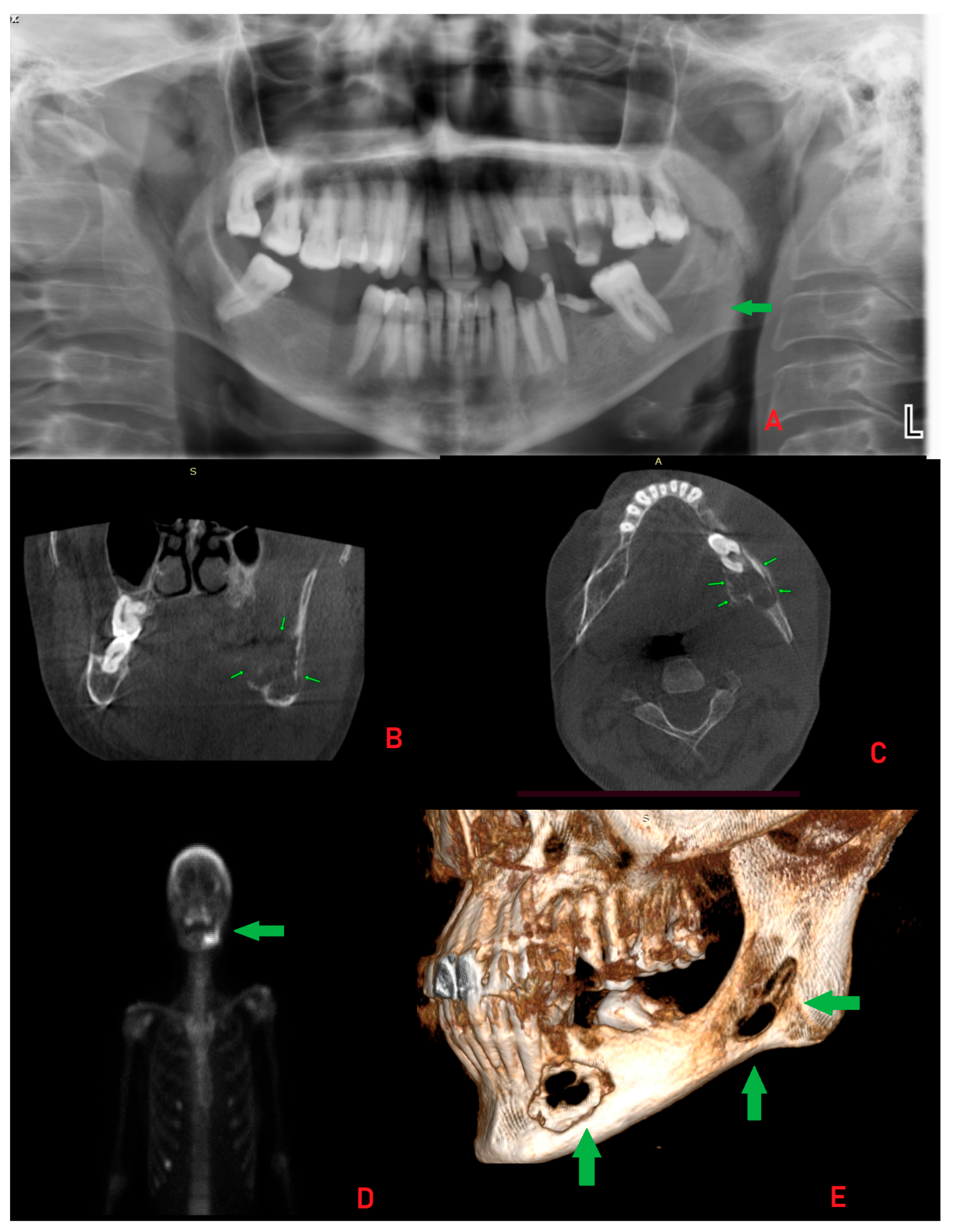 Diagnostics 15 02798 g002 Diagnostics 15 02798 g002