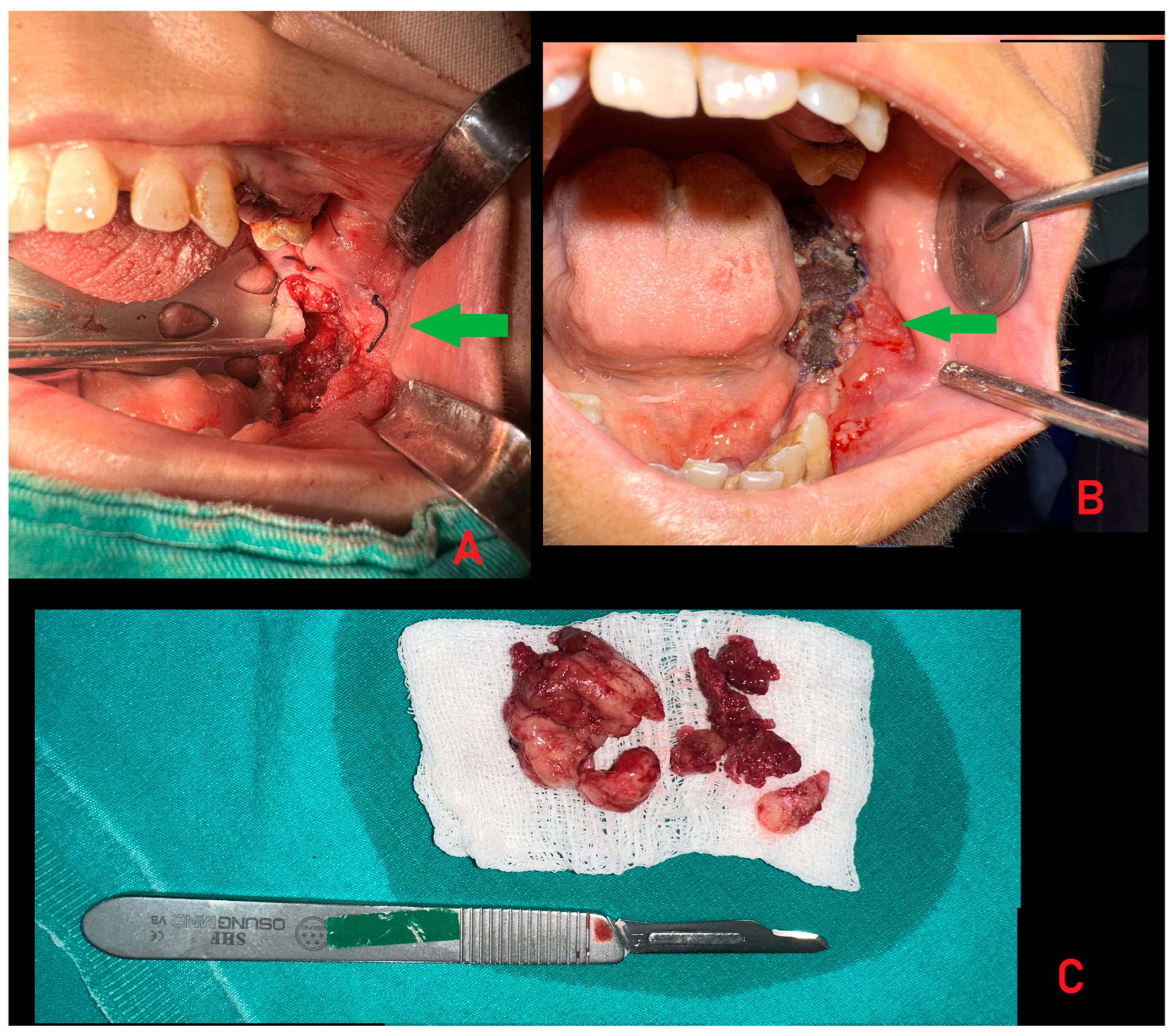 Diagnostics 15 02798 g003 Diagnostics 15 02798 g003