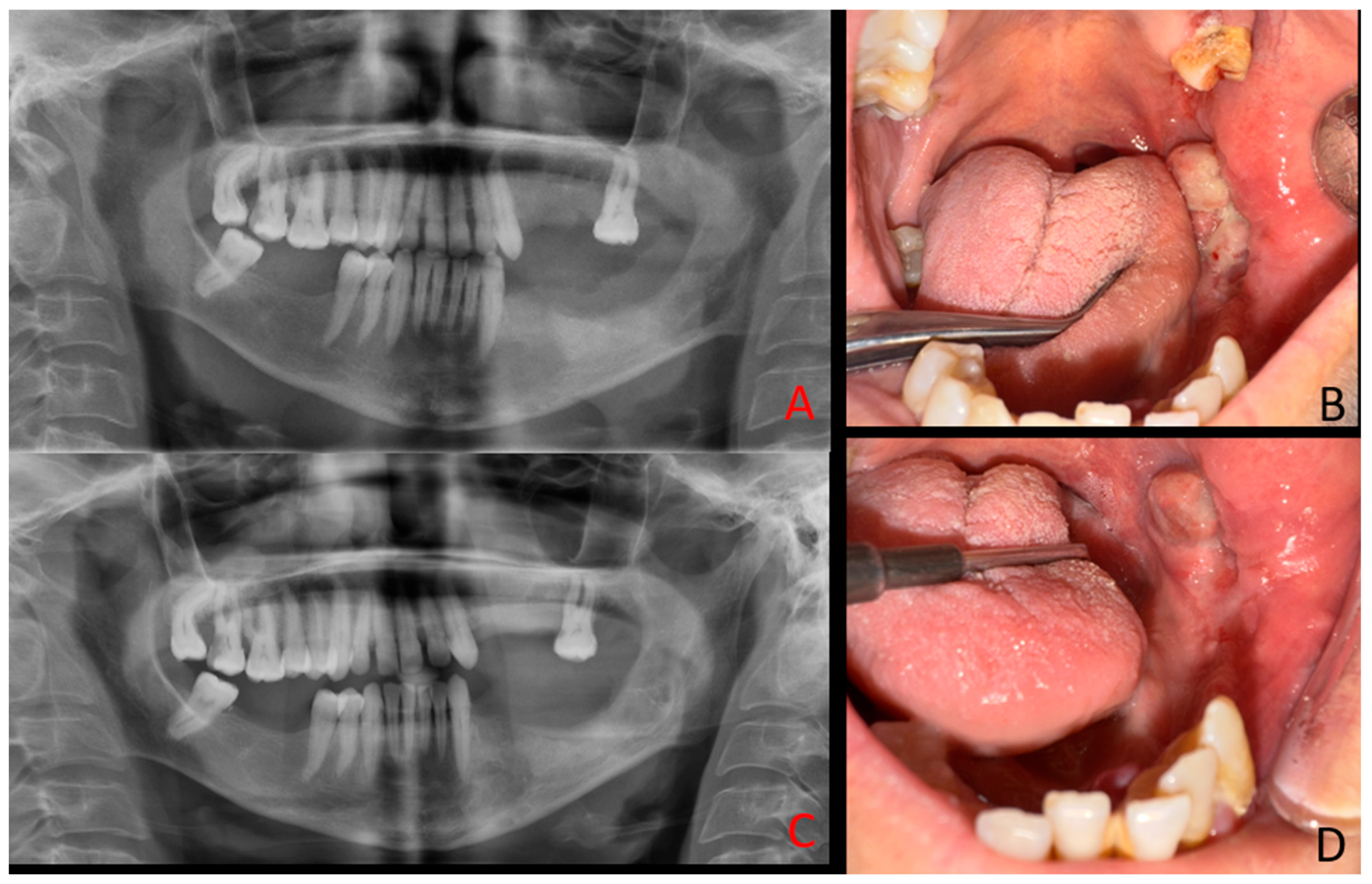 Diagnostics 15 02798 g005 Diagnostics 15 02798 g005