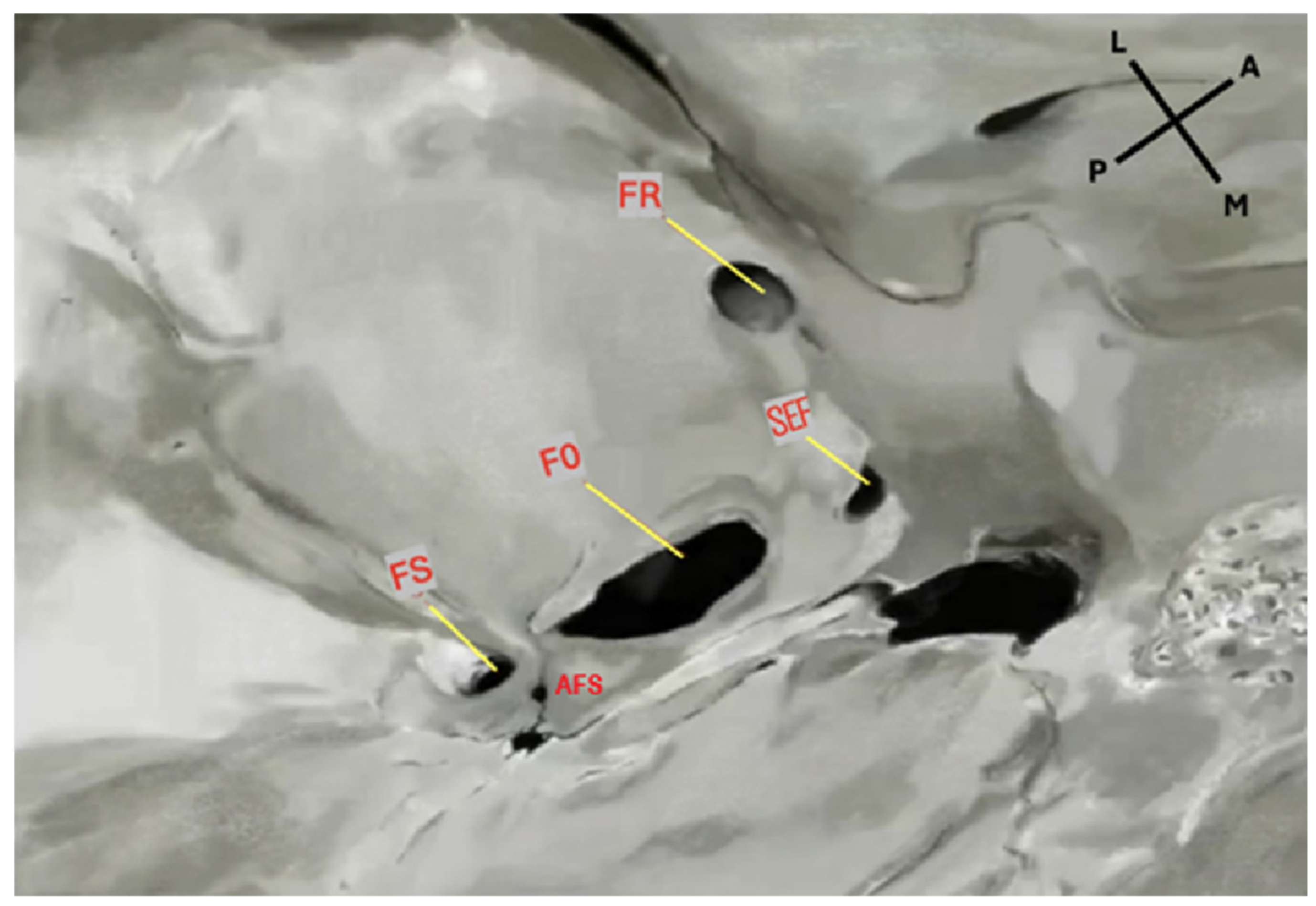 Diagnostics 15 02800 g001 Diagnostics 15 02800 g001