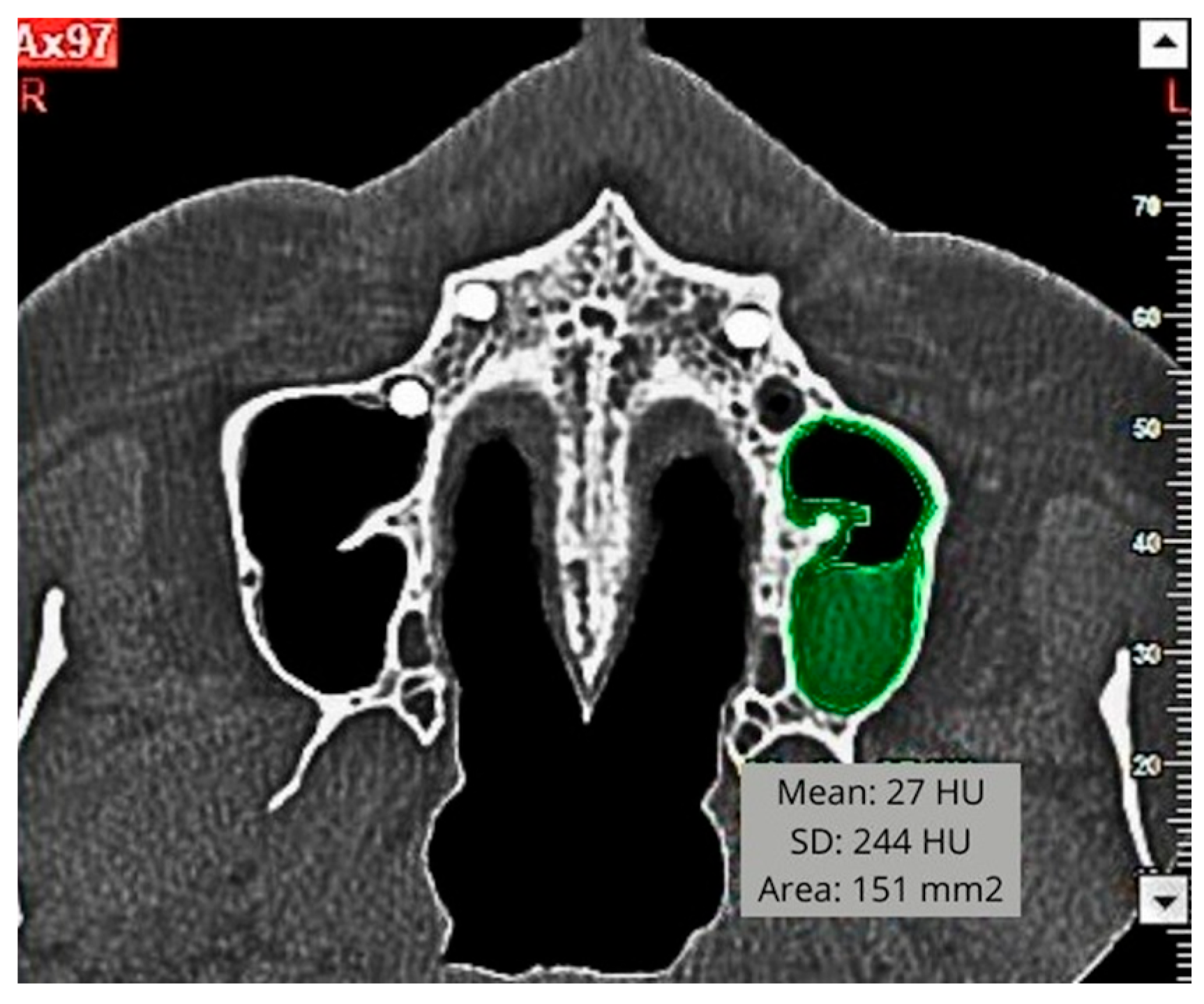 Diagnostics 15 02809 g002