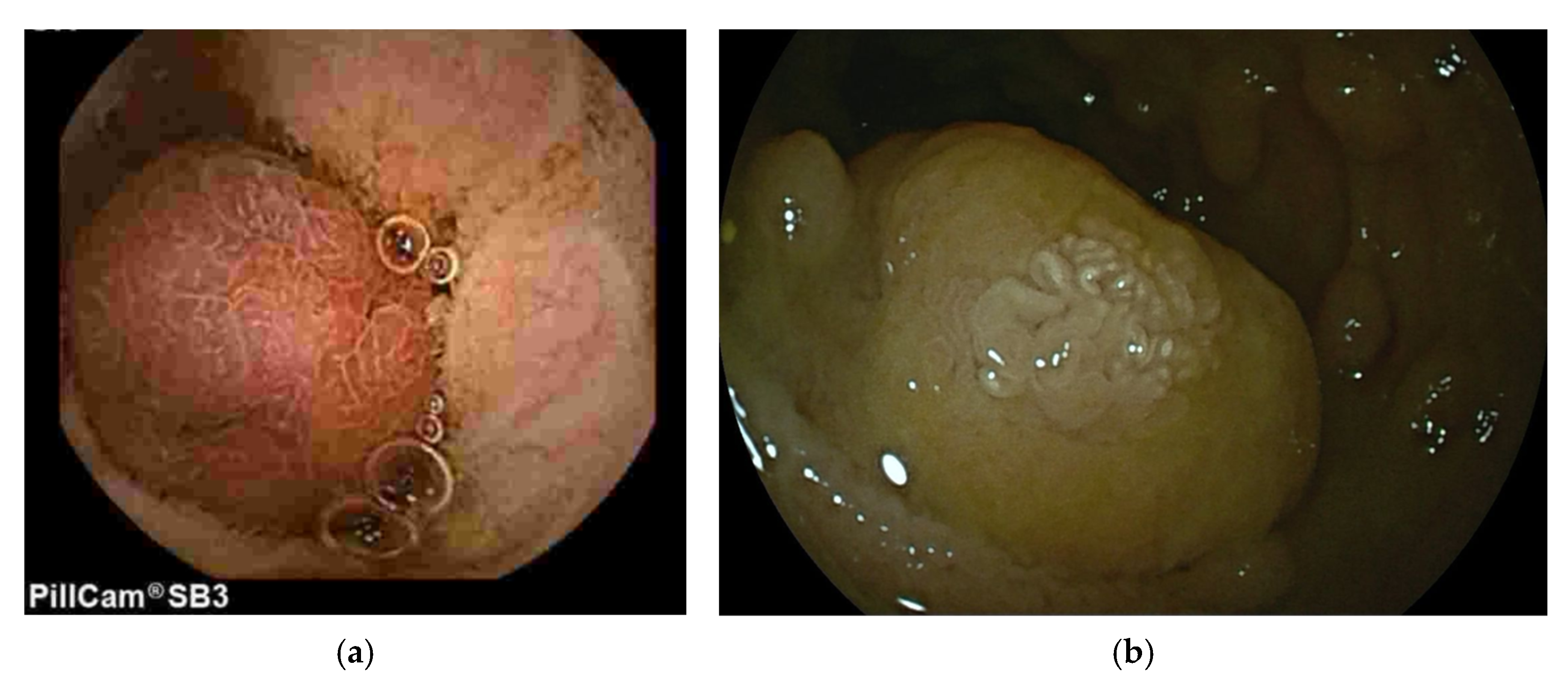 Diagnostics 15 02813 g001 Diagnostics 15 02813 g001