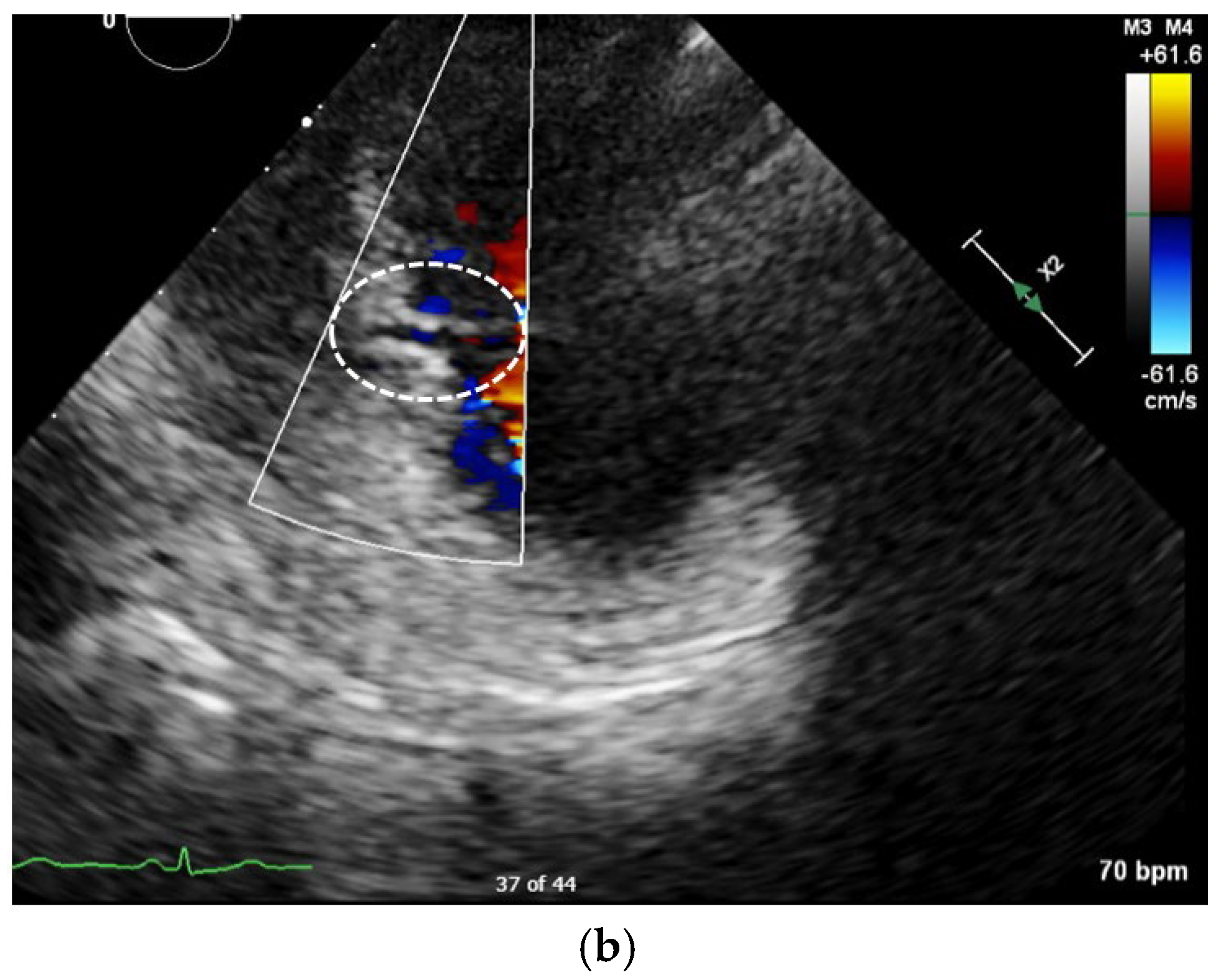 Diagnostics 15 02814 g001b Diagnostics 15 02814 g001b