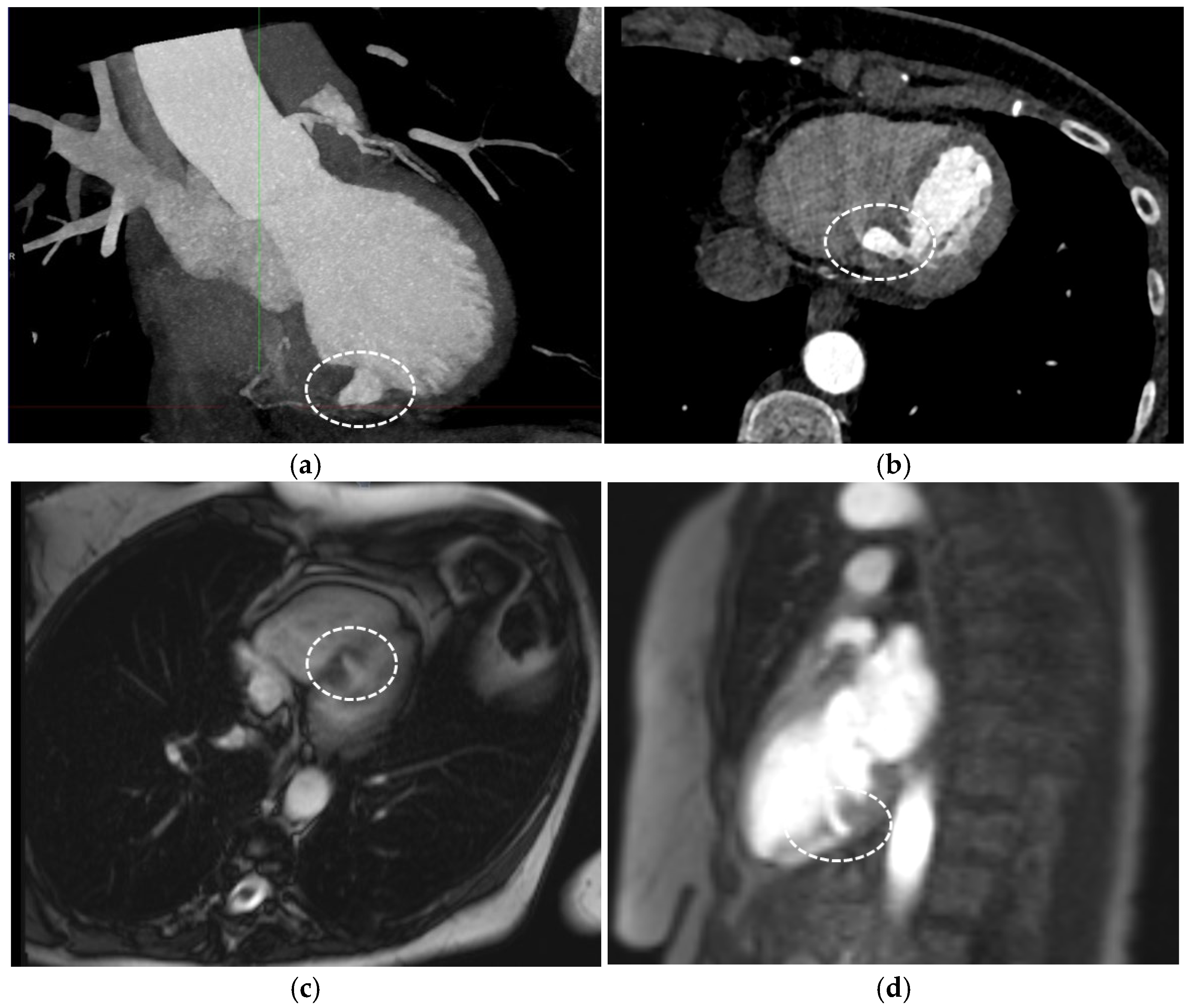 Diagnostics 15 02814 g002a Diagnostics 15 02814 g002a