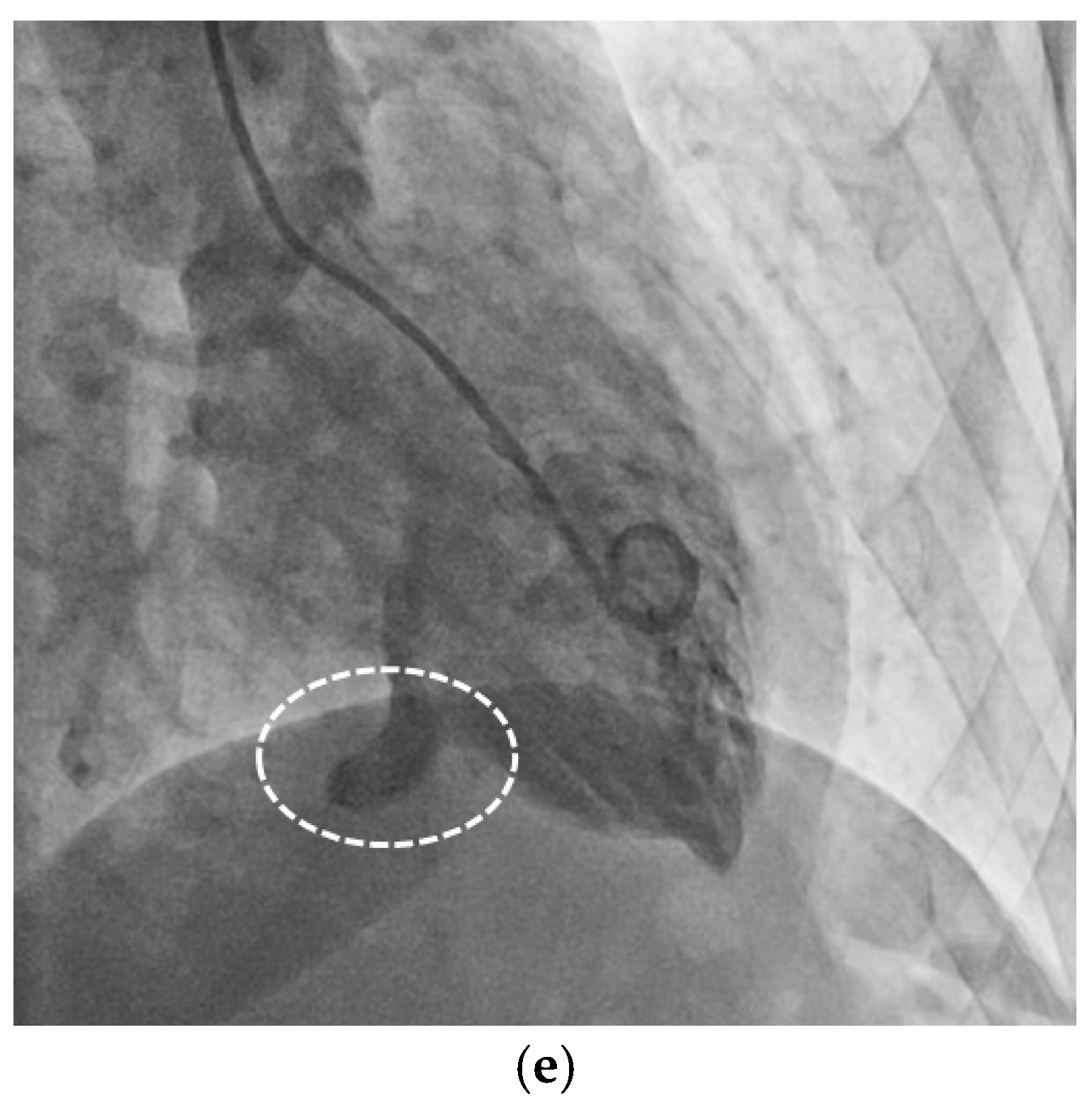 Diagnostics 15 02814 g002b Diagnostics 15 02814 g002b
