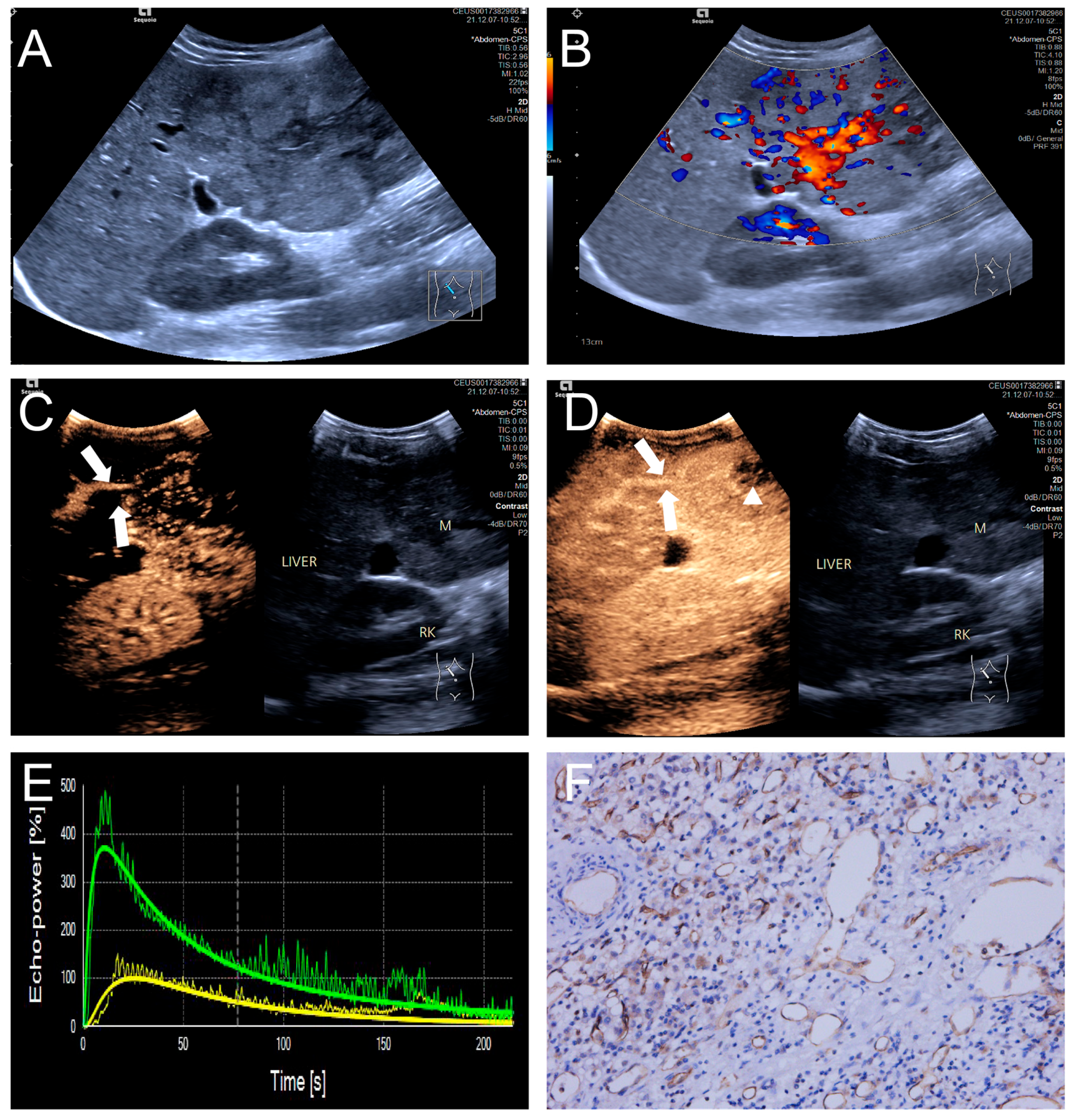 Diagnostics 15 02819 g004