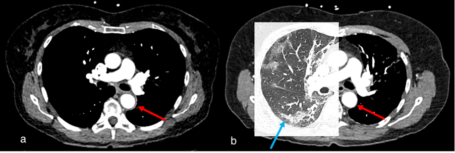 Diagnostics 15 02832 g004 Diagnostics 15 02832 g004