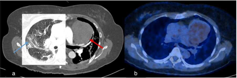 Diagnostics 15 02832 g005 Diagnostics 15 02832 g005