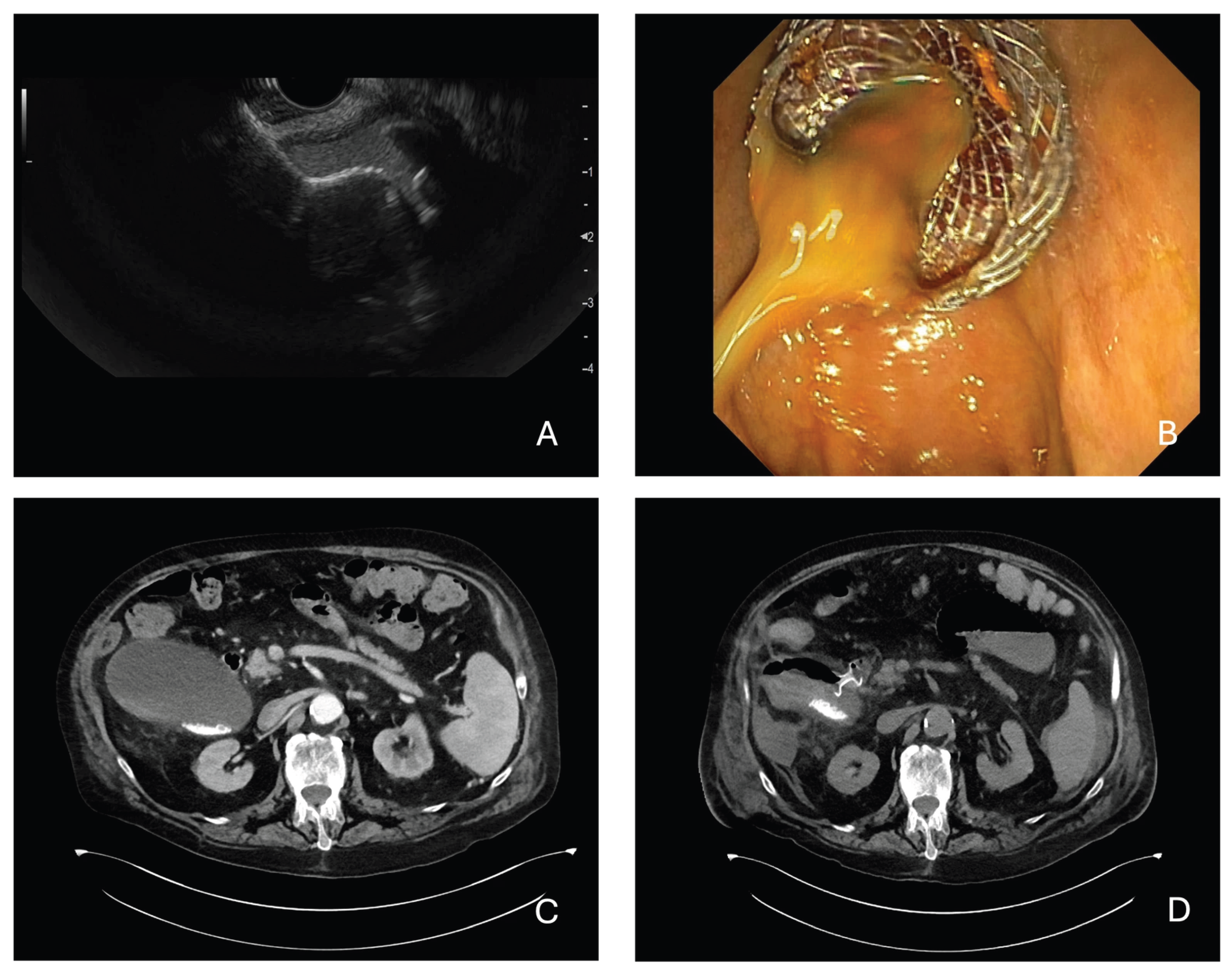 Diagnostics 15 02835 g002 Diagnostics 15 02835 g002