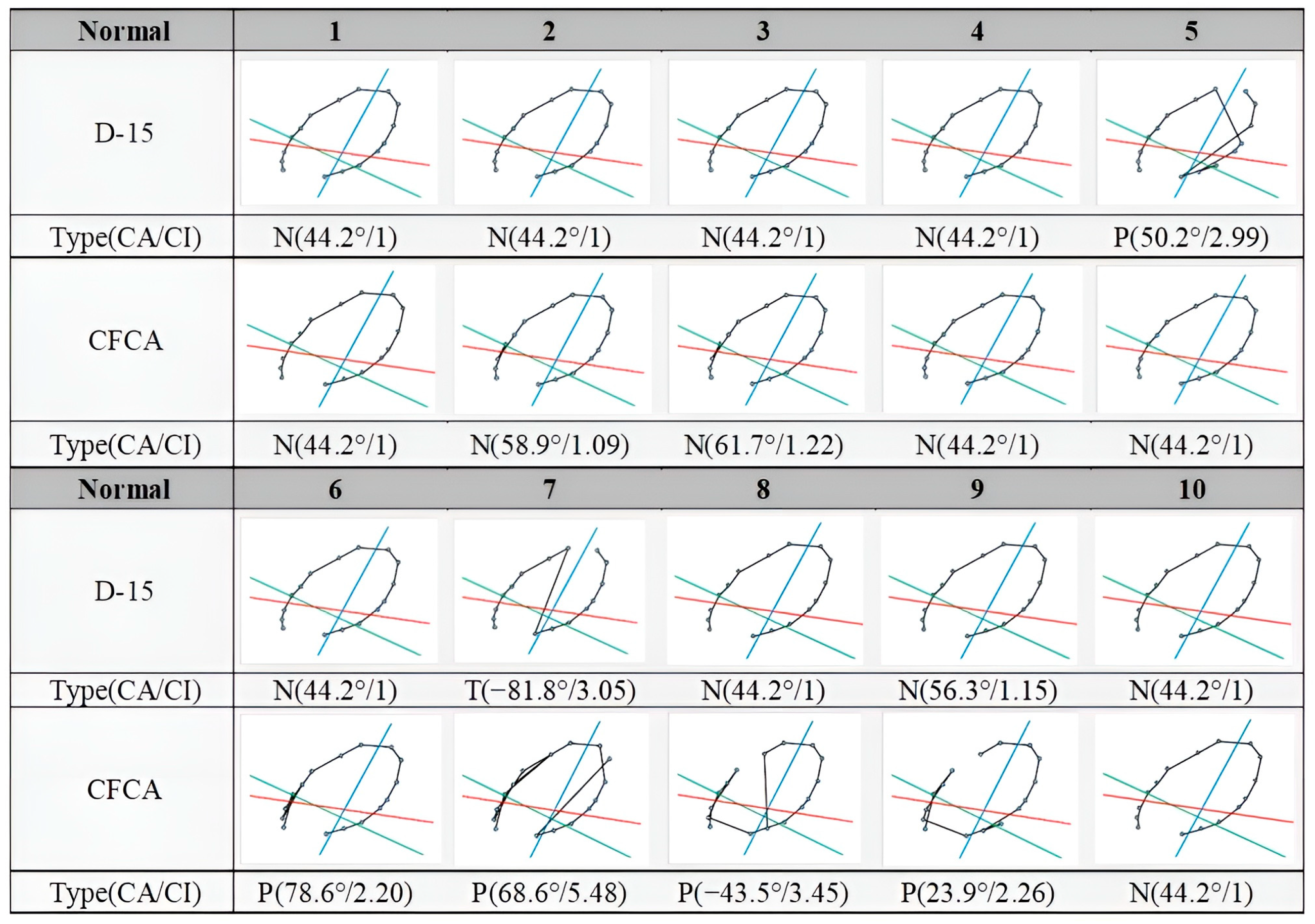 Diagnostics 15 02837 g004 Diagnostics 15 02837 g004