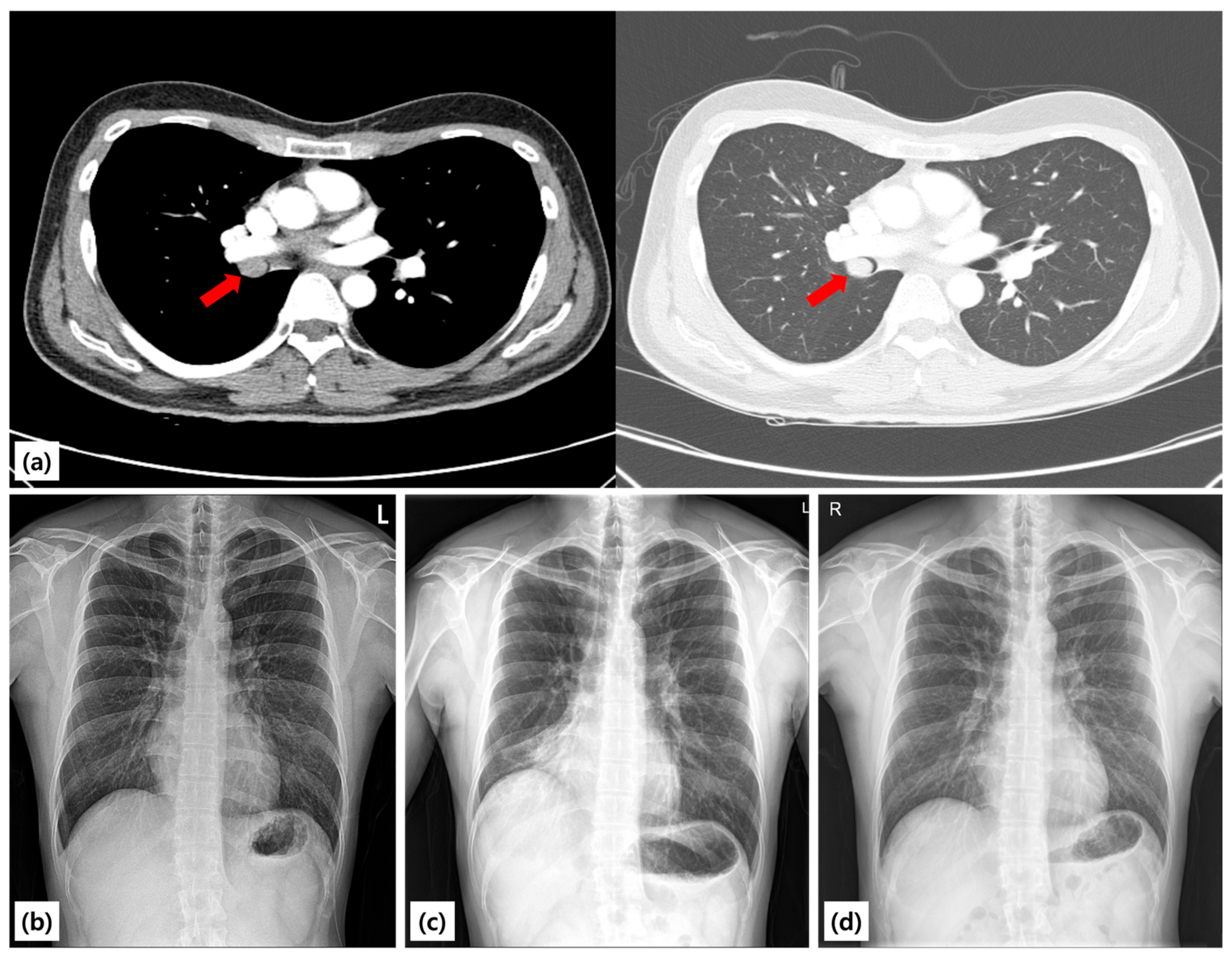 Diagnostics 15 02850 g001