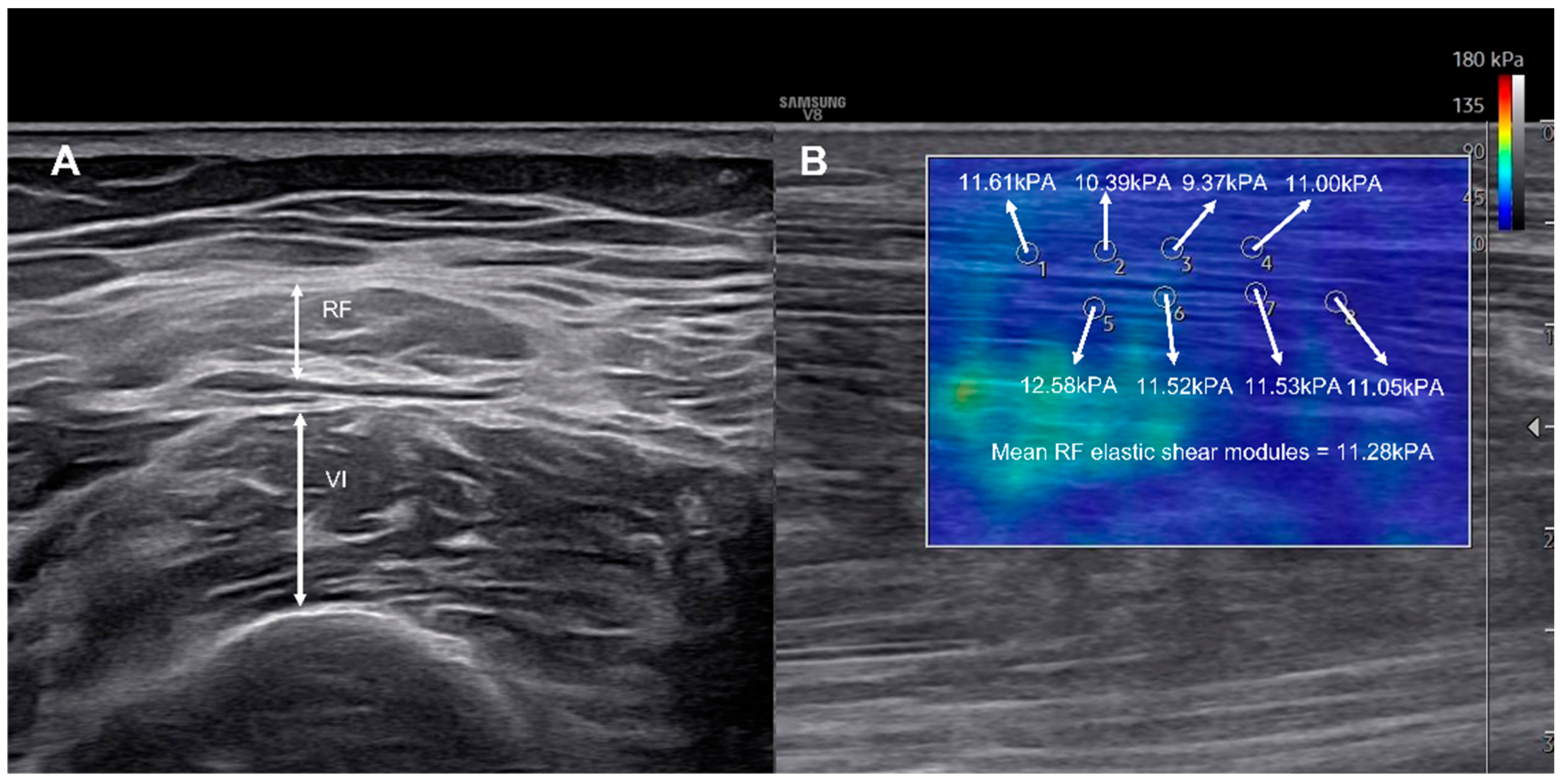 Diagnostics 15 02854 g001