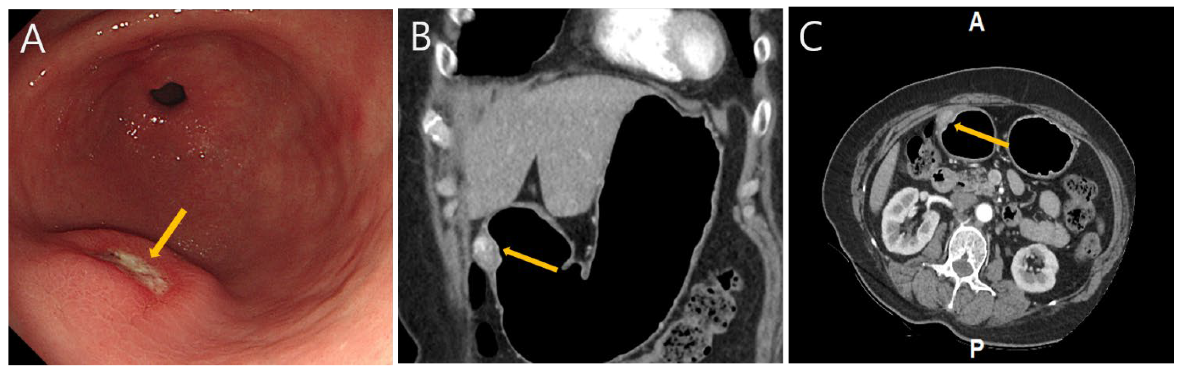 Diagnostics 15 02865 g001 Diagnostics 15 02865 g001