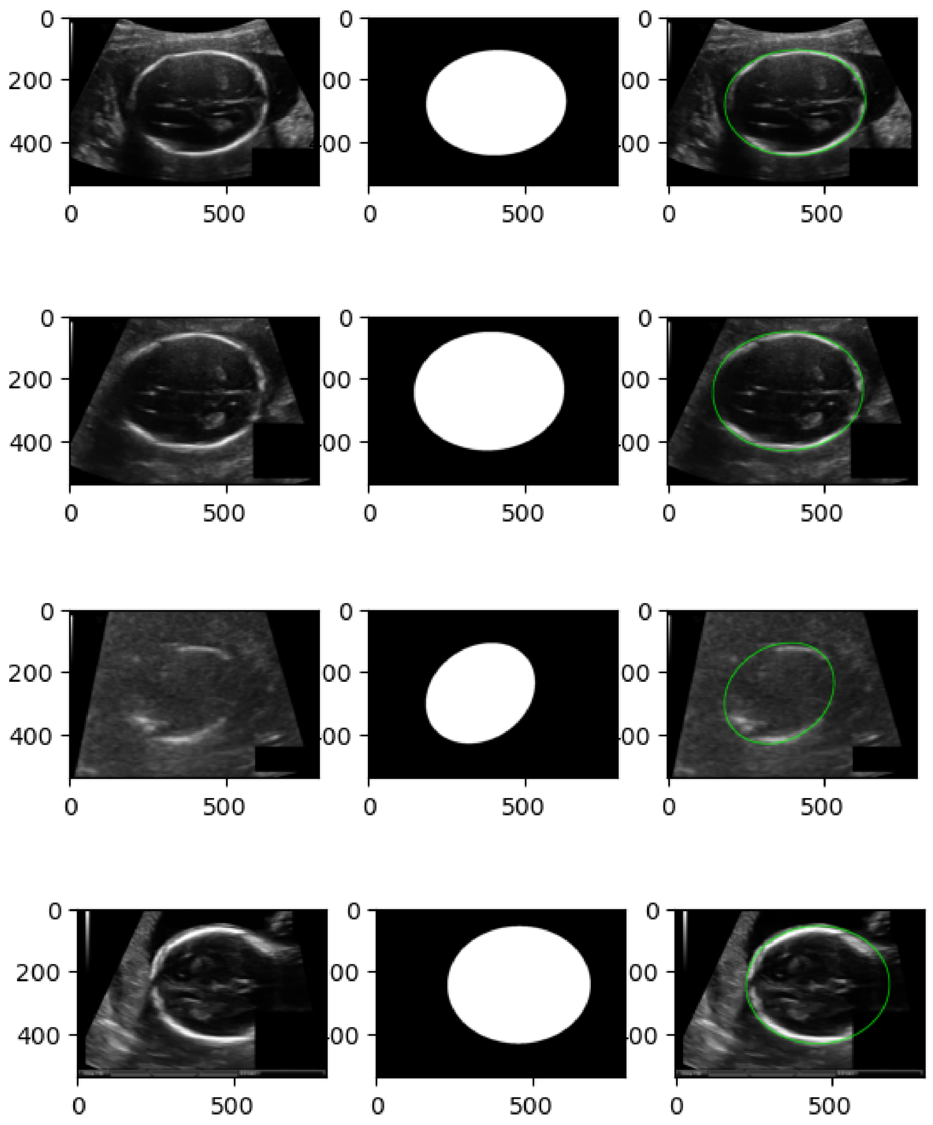 Diagnostics 15 02879 g010 Diagnostics 15 02879 g010