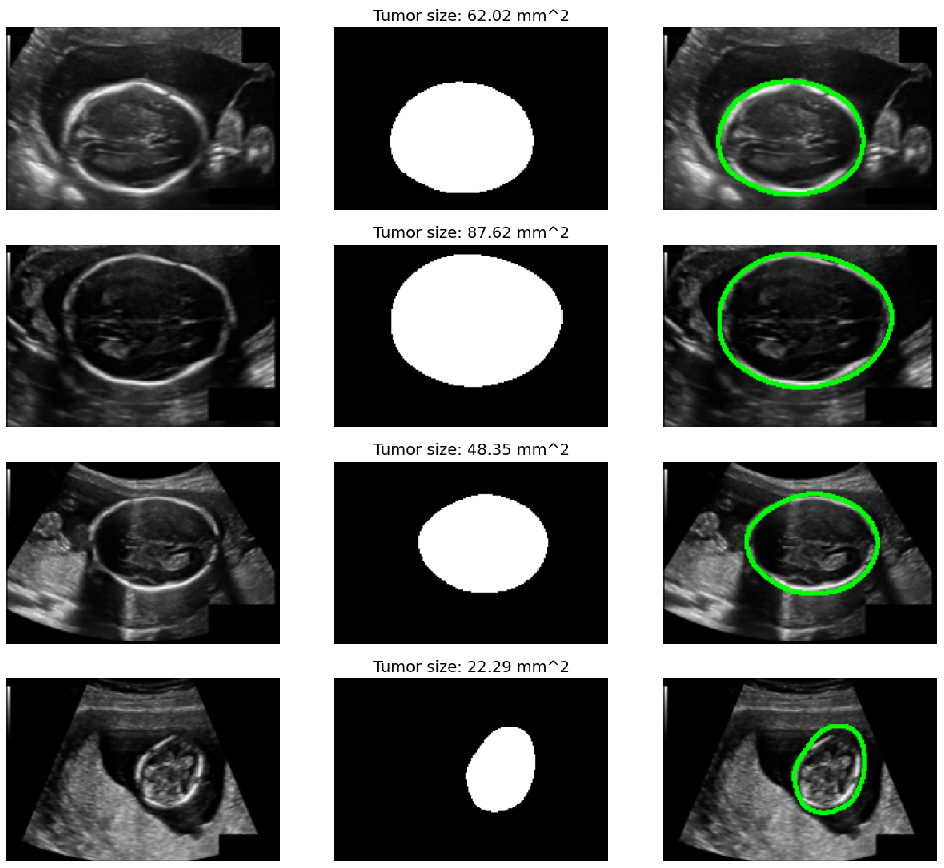 Diagnostics 15 02879 g012 Diagnostics 15 02879 g012