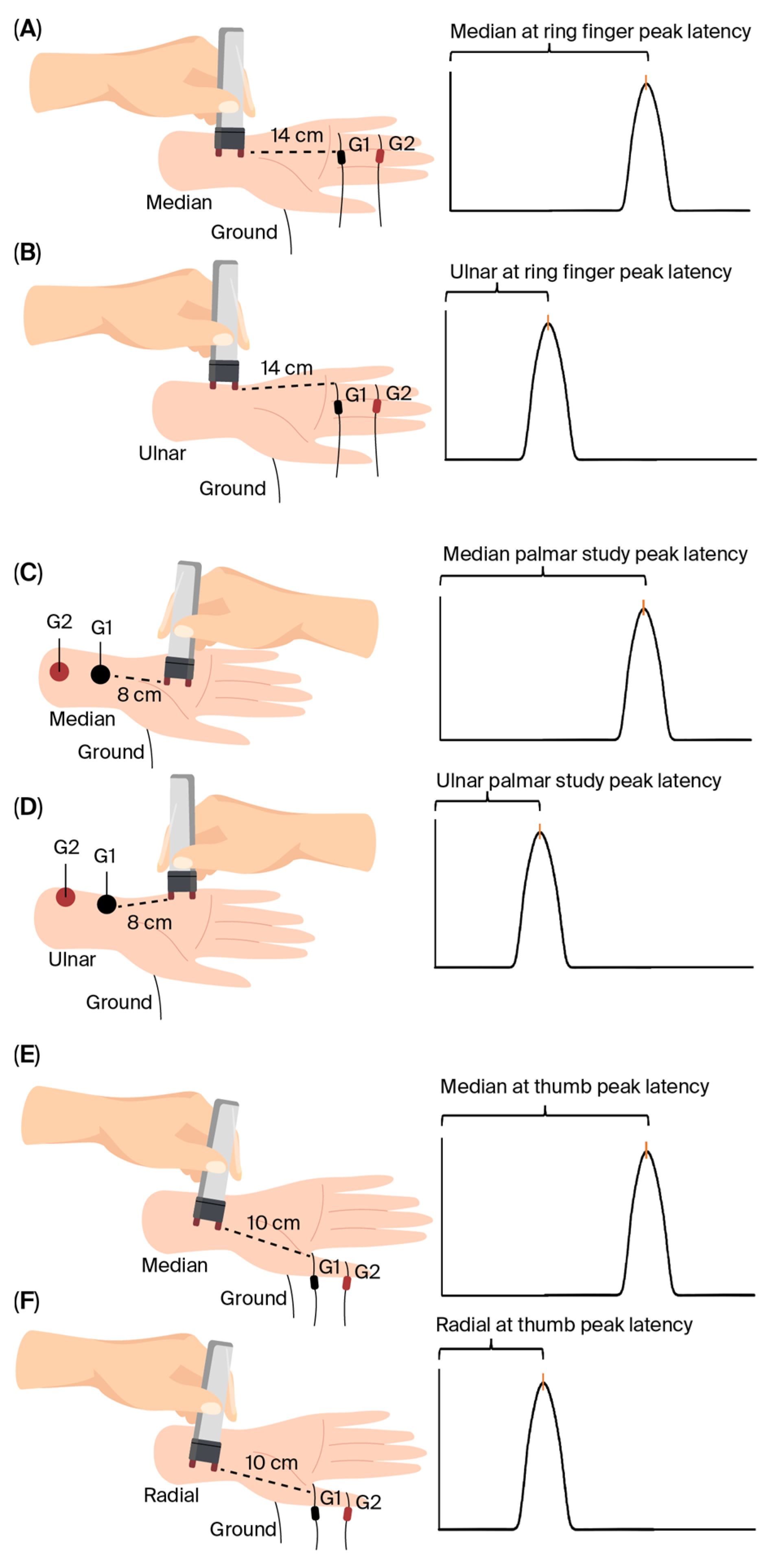 Diagnostics 15 02888 g001 Diagnostics 15 02888 g001
