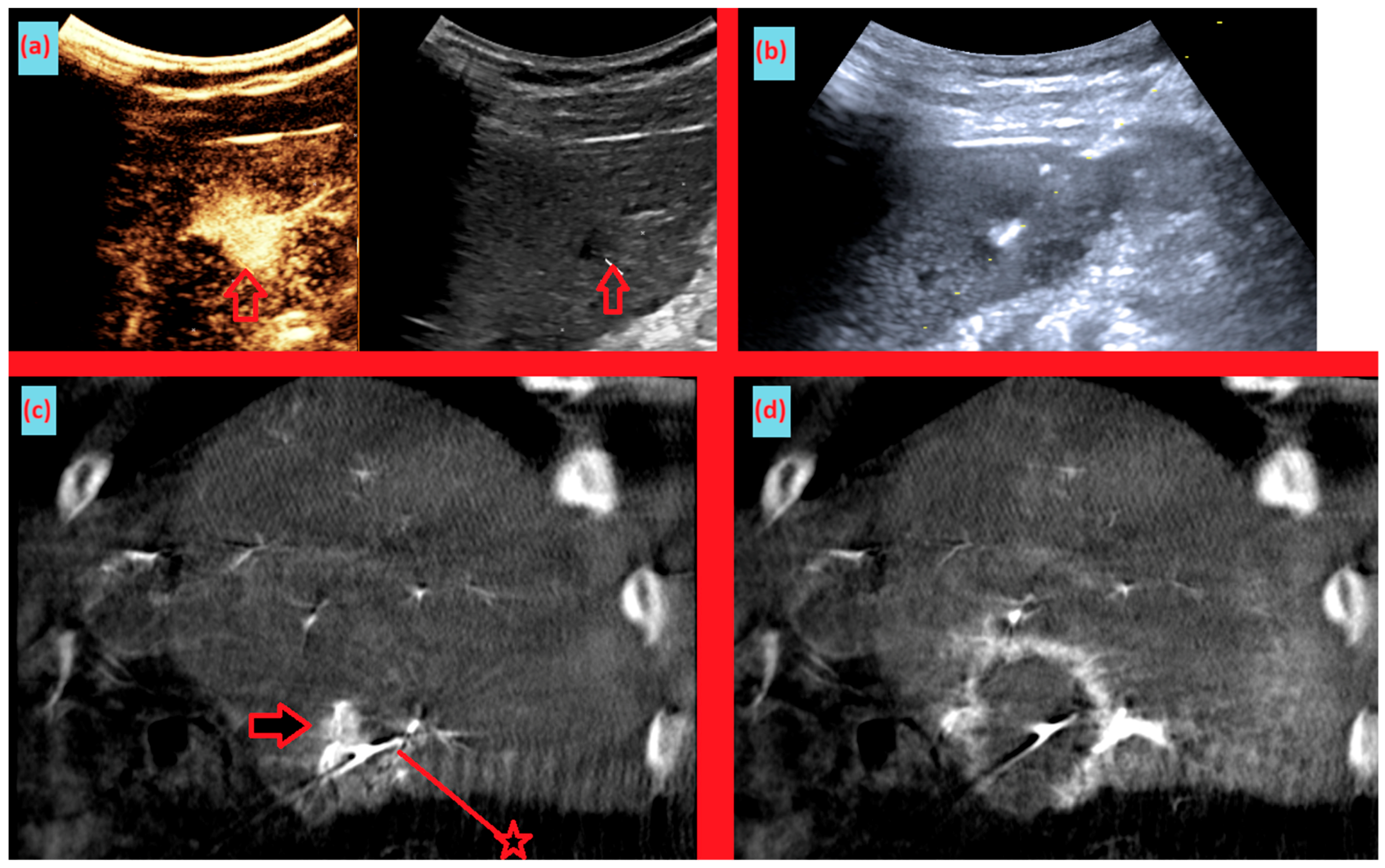 Diagnostics 15 02898 g005