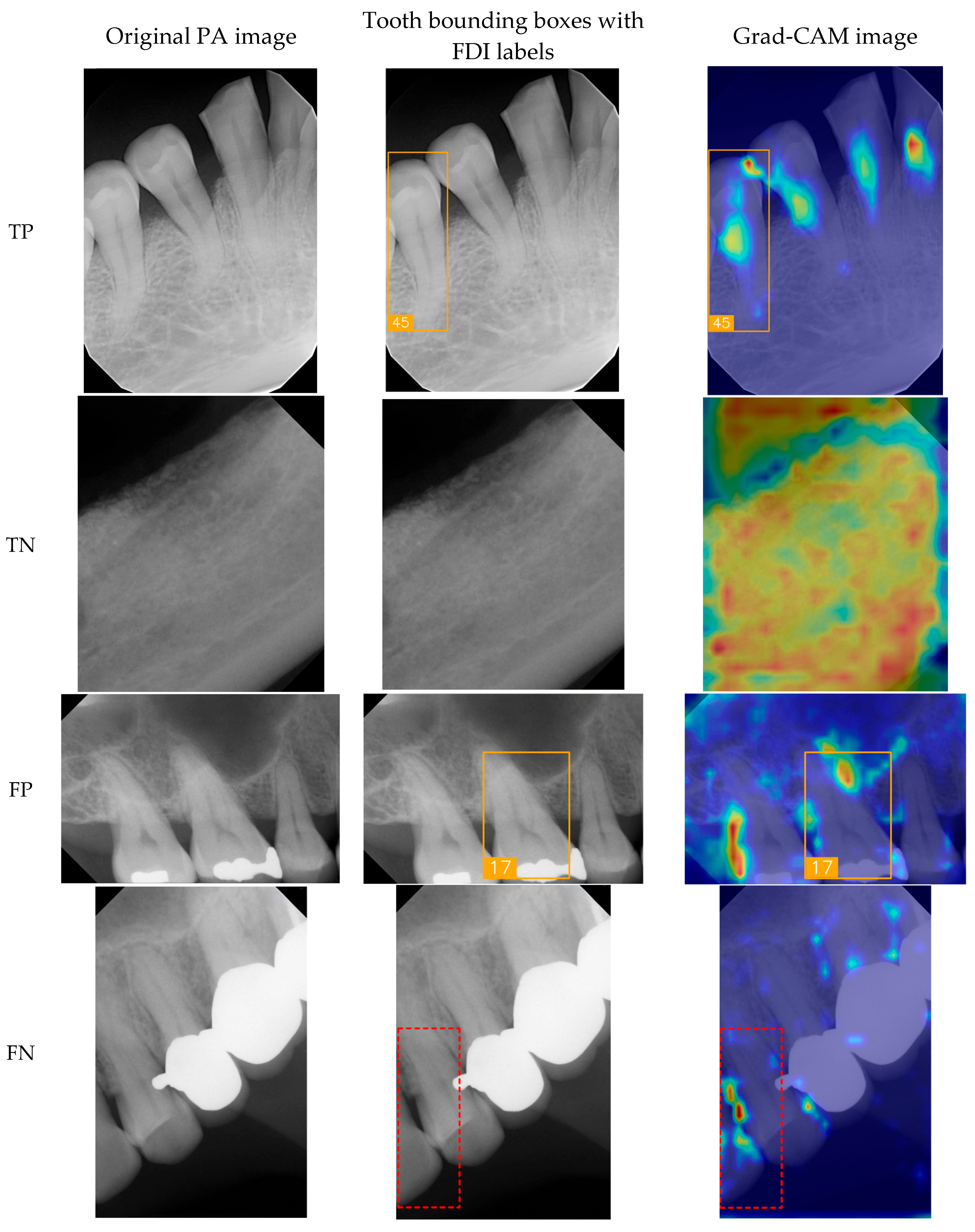 Diagnostics 15 02900 g008 Diagnostics 15 02900 g008