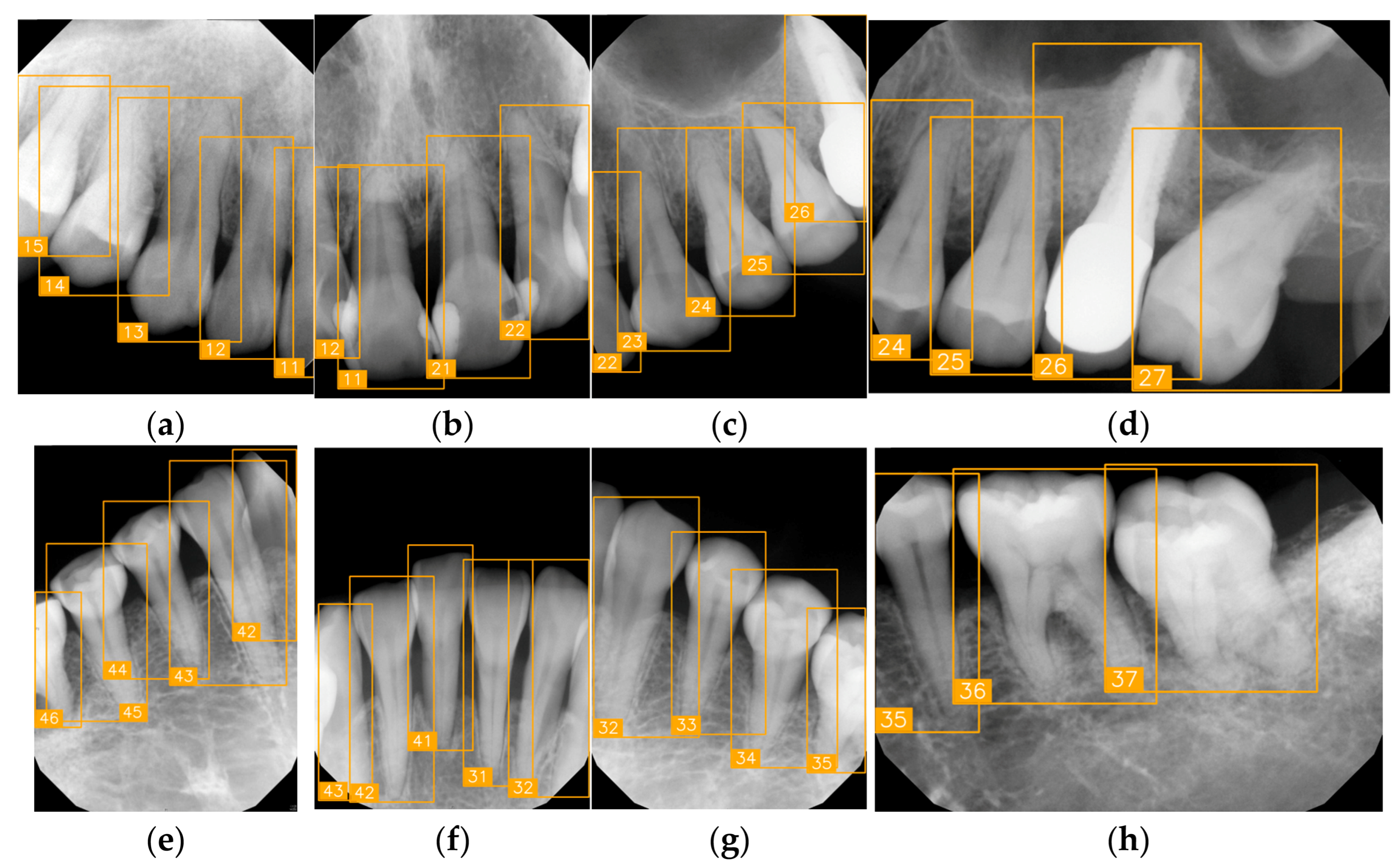 Diagnostics 15 02900 g010 Diagnostics 15 02900 g010