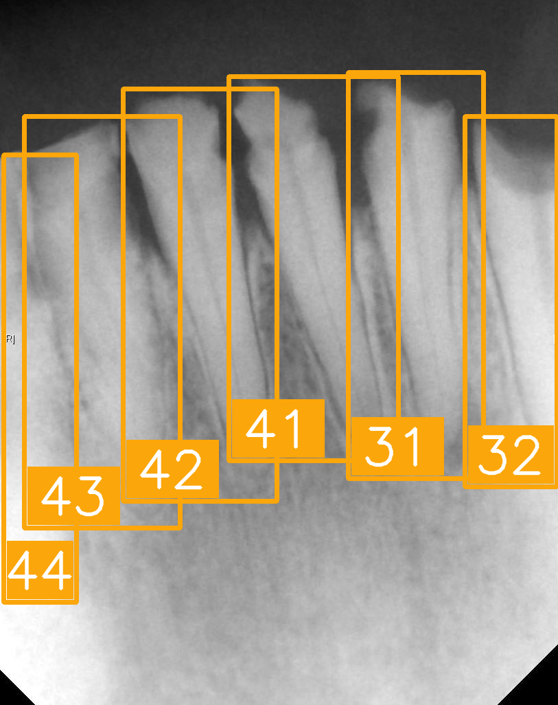 Diagnostics 15 02900 i004 Diagnostics 15 02900 i004